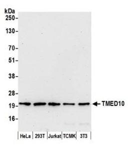 Detection of human and mouse TMED10 by western blot.