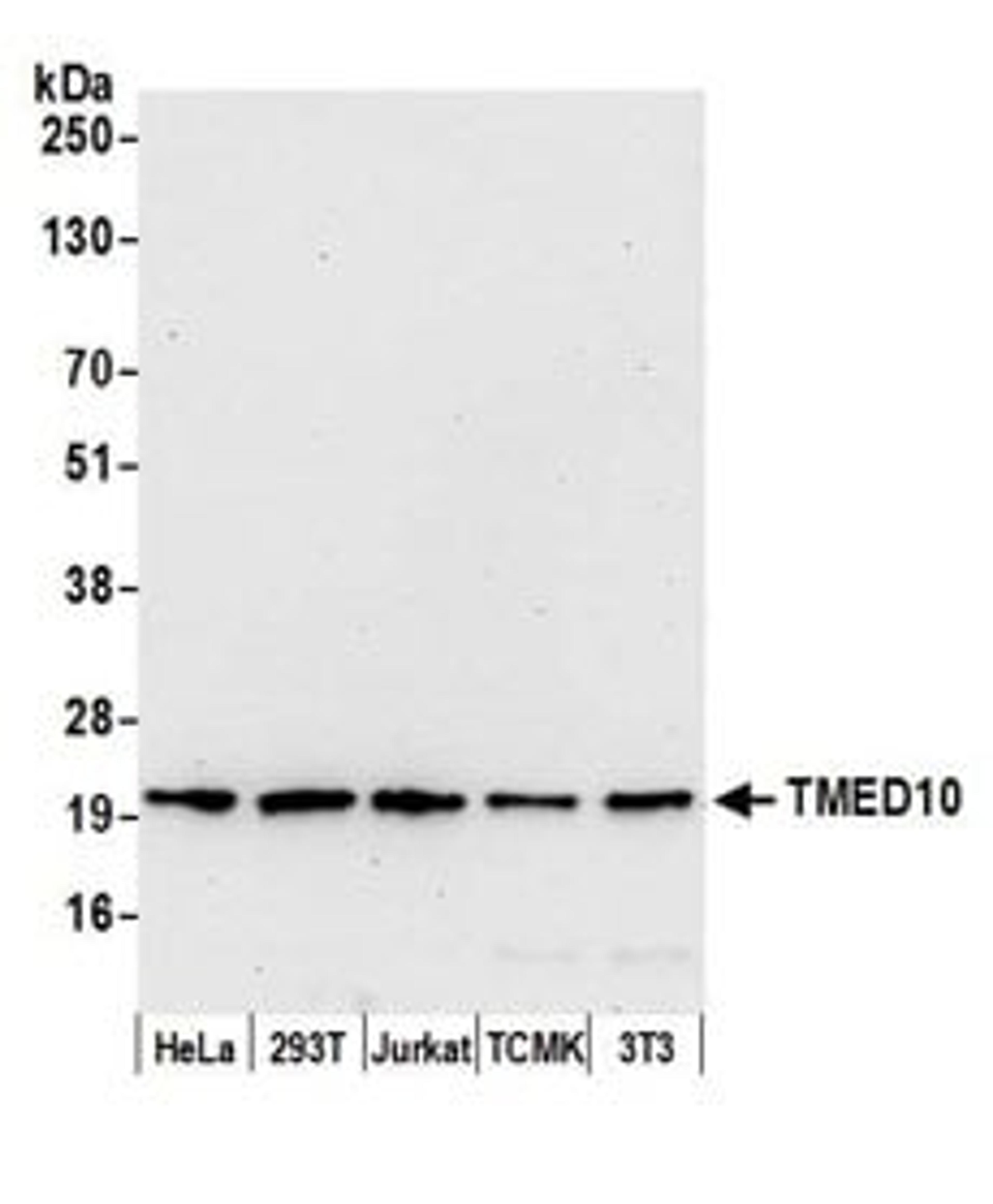 Detection of human and mouse TMED10 by western blot.