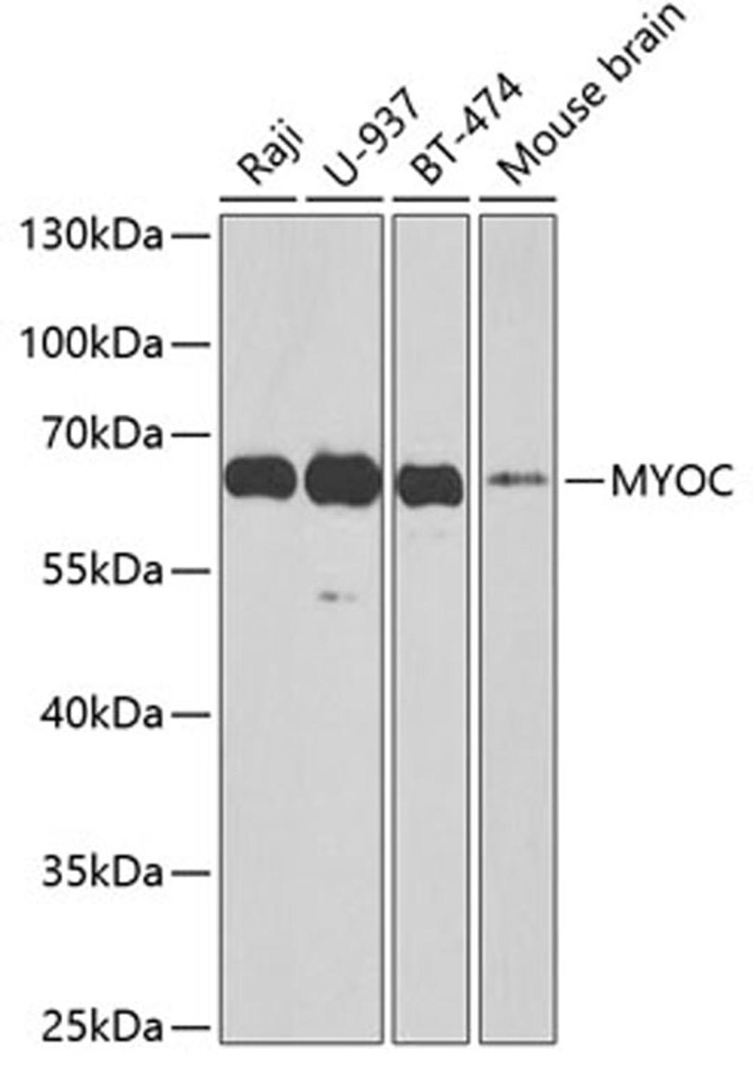 Western blot - MYOC antibody (A1589)