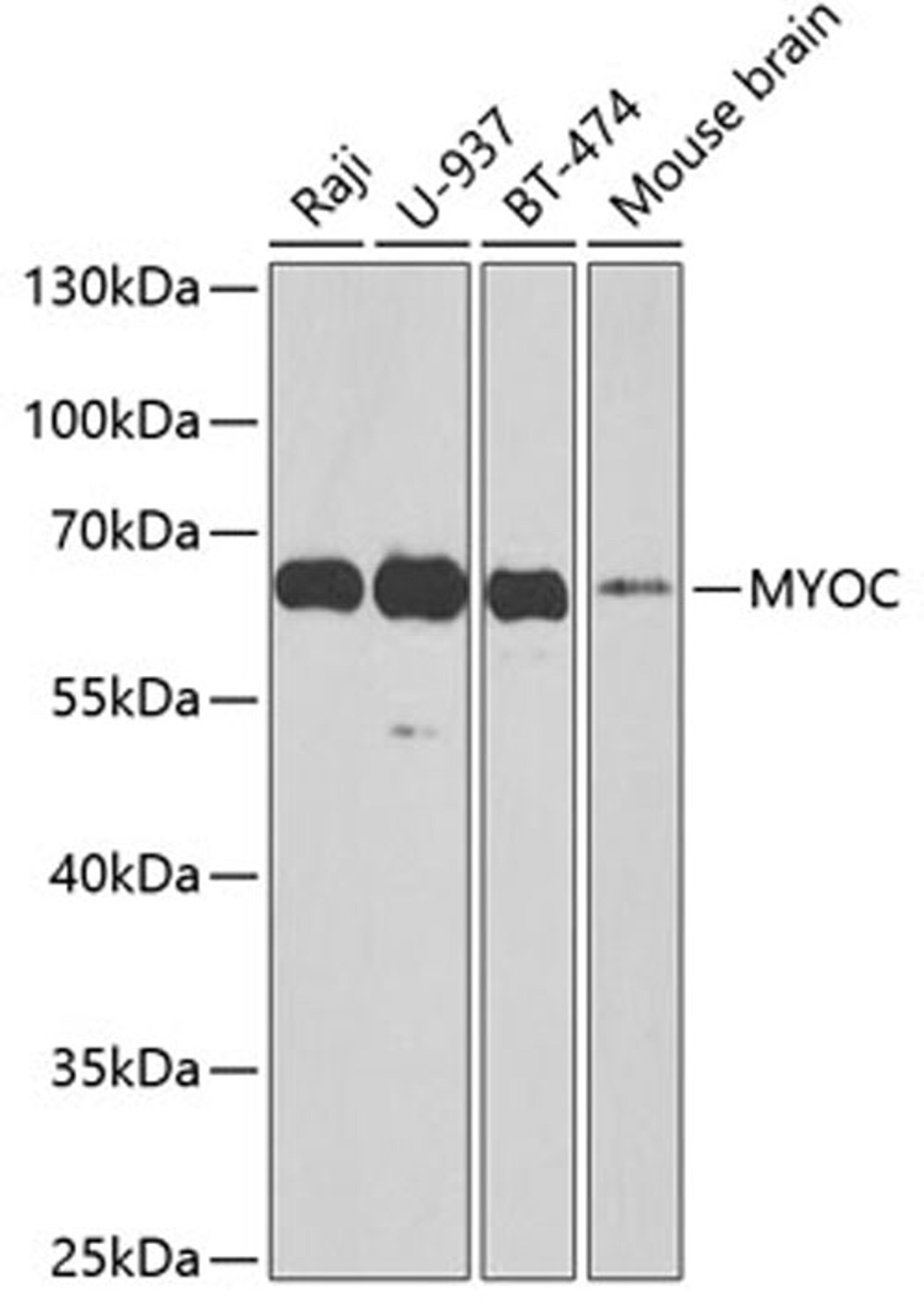 Western blot - MYOC antibody (A1589)