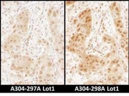 Detection of human RAN by immunohistochemistry.