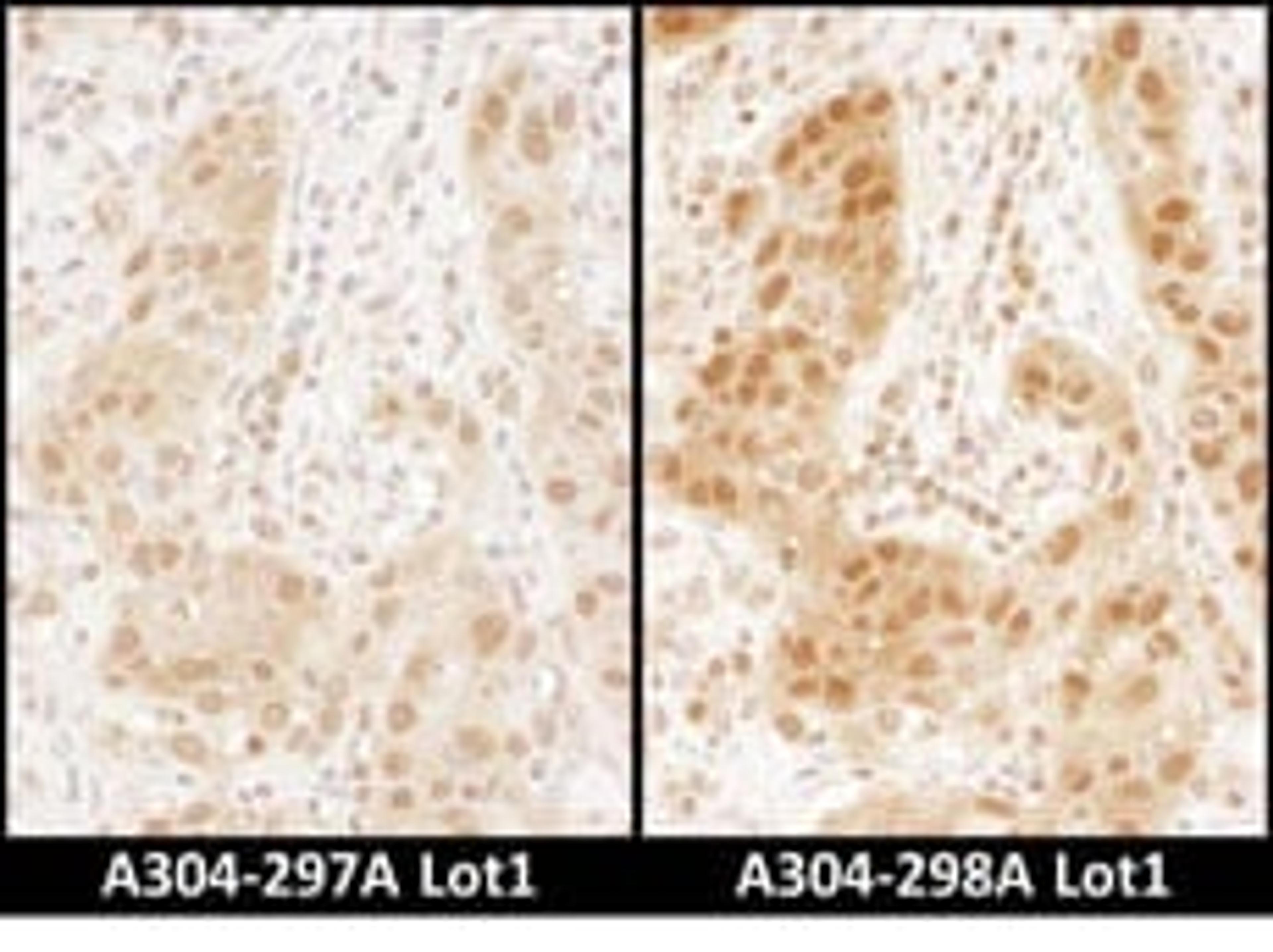 Detection of human RAN by immunohistochemistry.