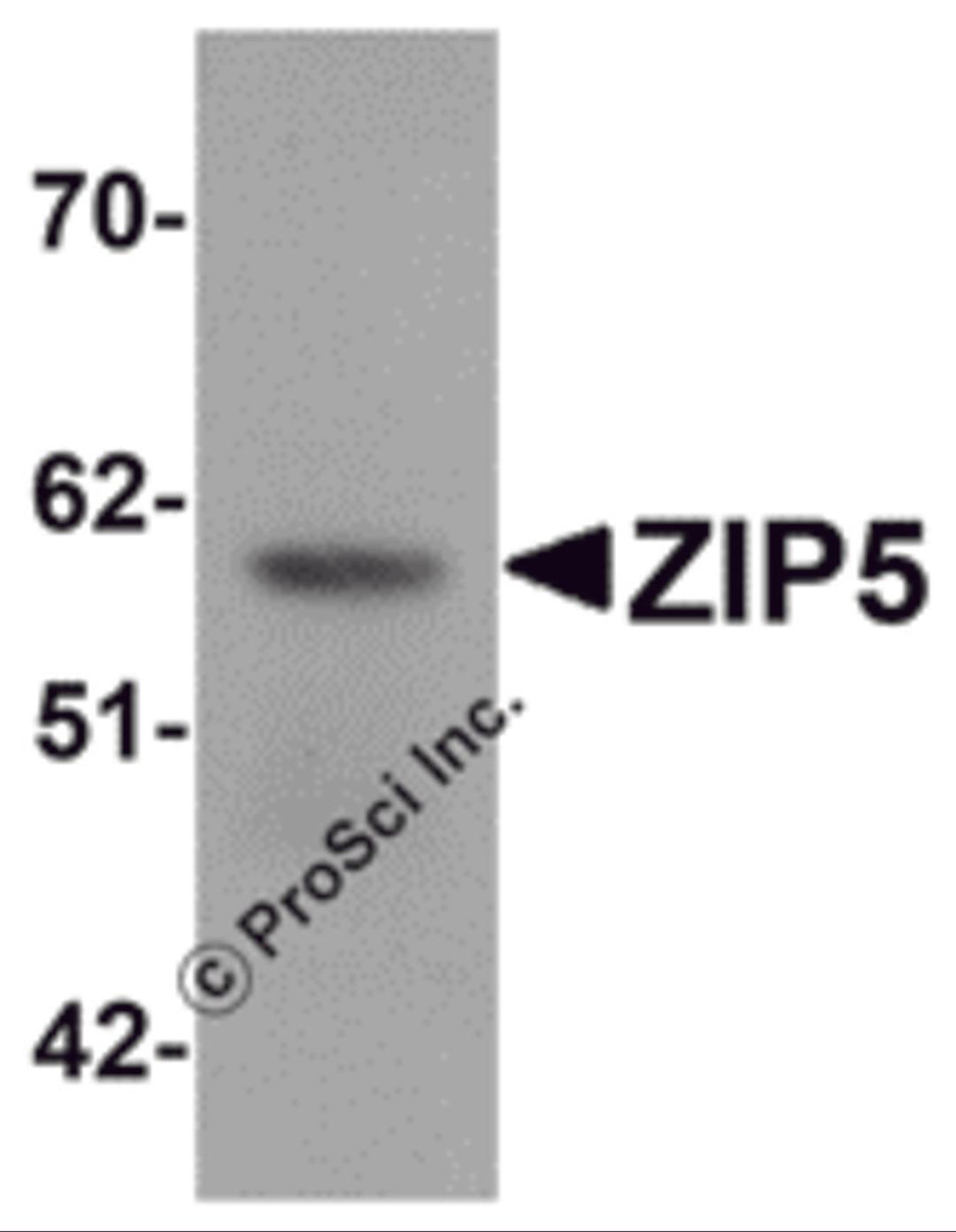 Western blot analysis of ZIP5 in human spleen tissue lysate with ZIP5 antibody at 1 μg/mL.