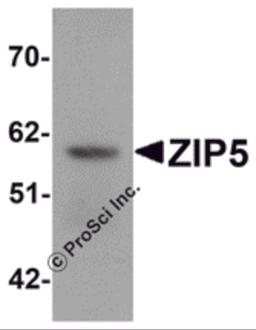 Western blot analysis of ZIP5 in human spleen tissue lysate with ZIP5 antibody at 1 μg/mL.