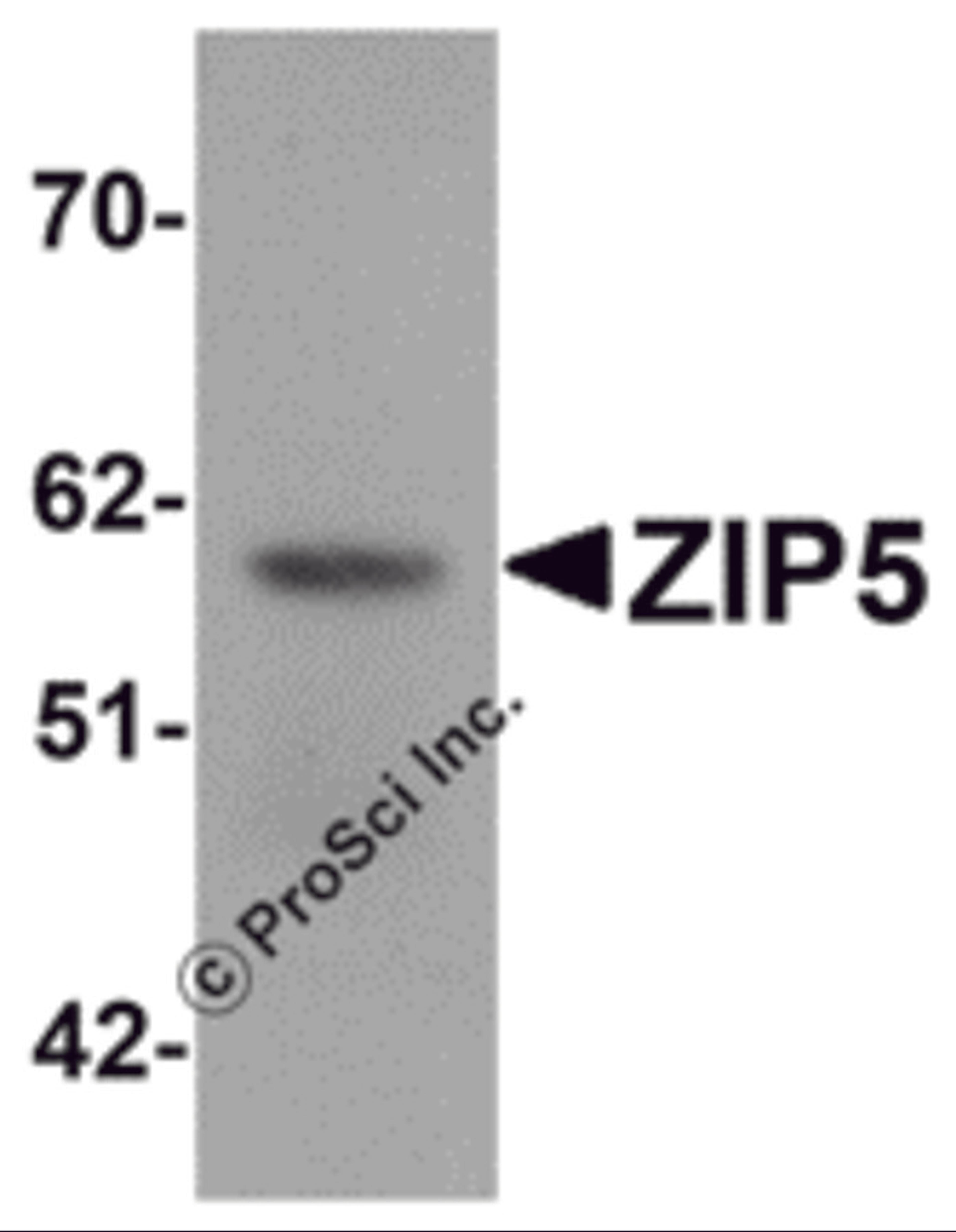 Western blot analysis of ZIP5 in human spleen tissue lysate with ZIP5 antibody at 1 μg/mL.
