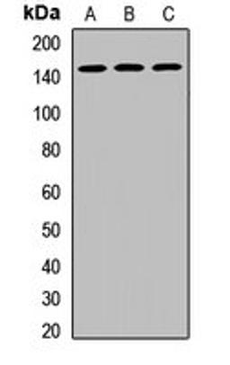 Western blot analysis of SKOV3 (Lane1), MCF7 (Lane2), mouse testis (Lane3) whole cell lysates using DHX38 antibody