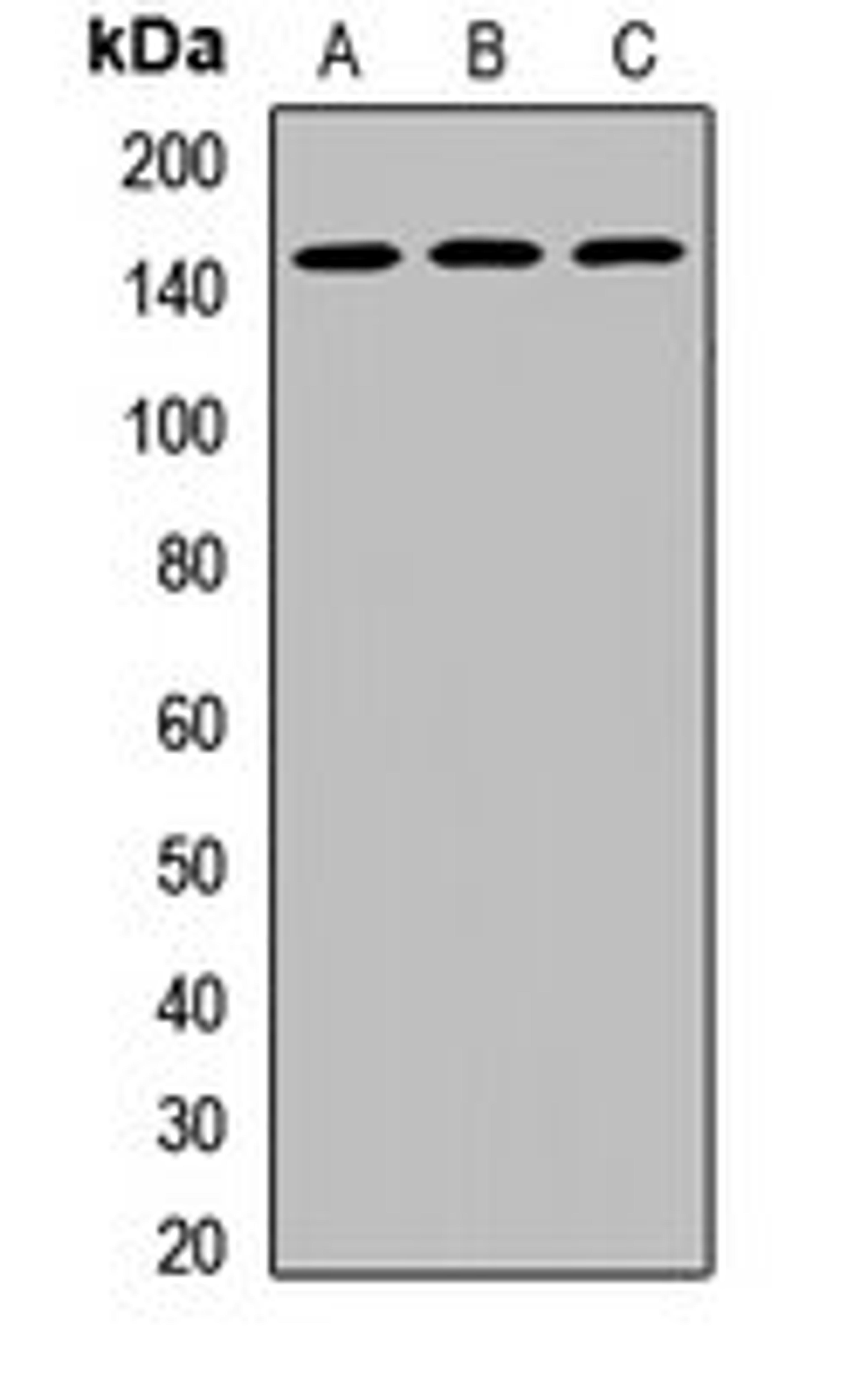 Western blot analysis of SKOV3 (Lane1), MCF7 (Lane2), mouse testis (Lane3) whole cell lysates using DHX38 antibody