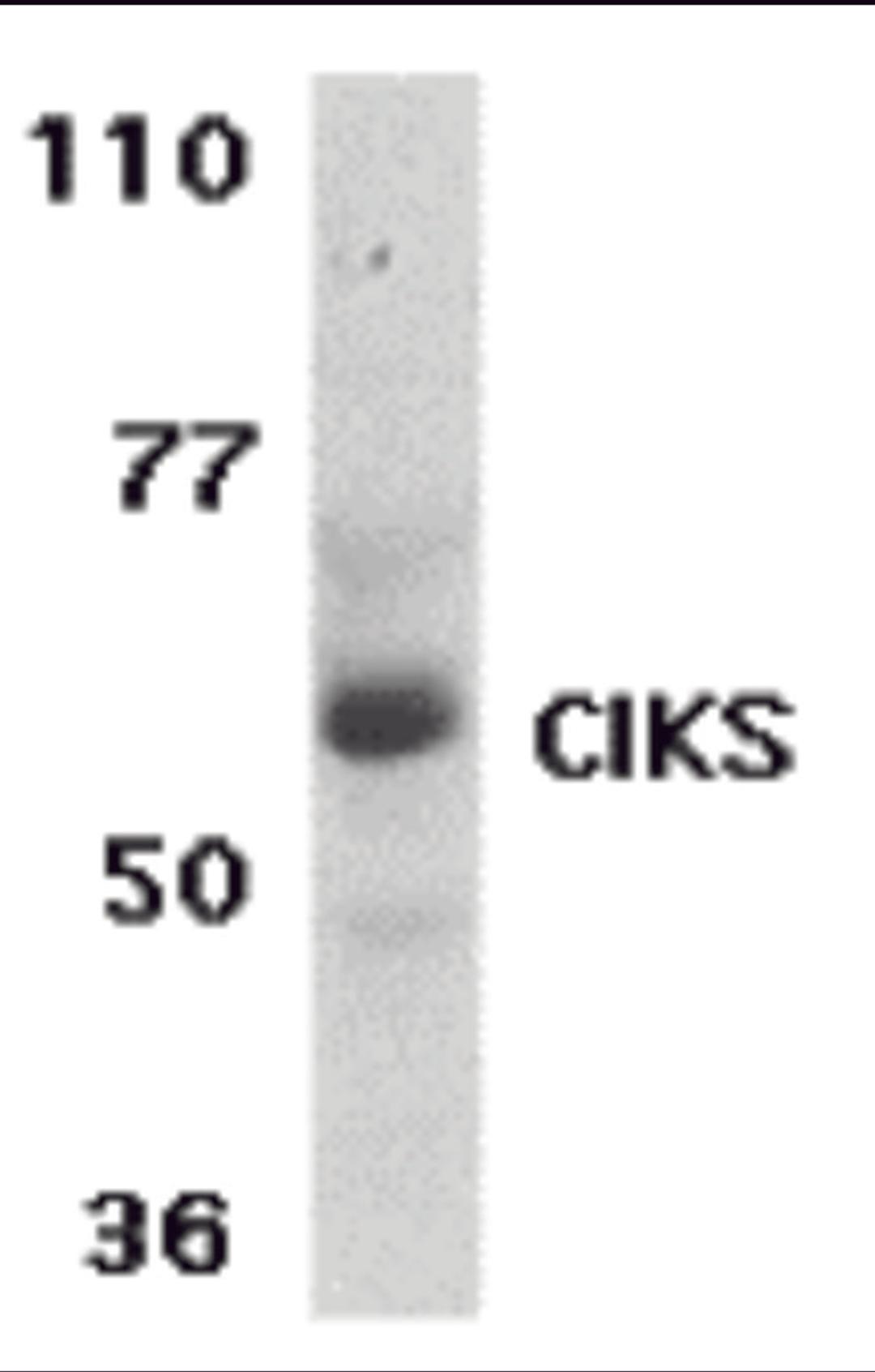 Western blot analysis of CIKS expression in human placenta tissue lysate with CIKS antibody at 1 &#956;g /ml.