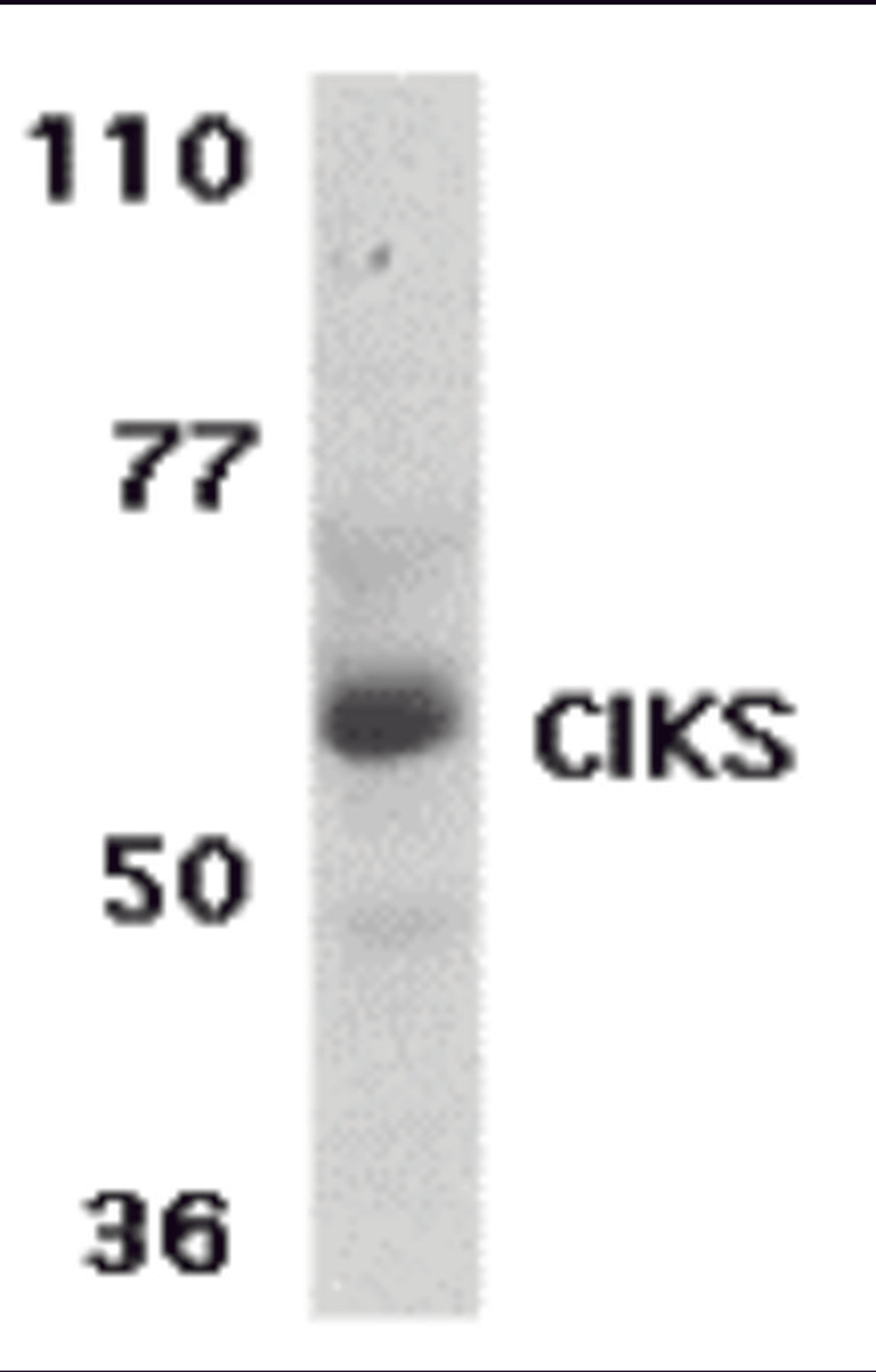 Western blot analysis of CIKS expression in human placenta tissue lysate with CIKS antibody at 1 &#956;g /ml.