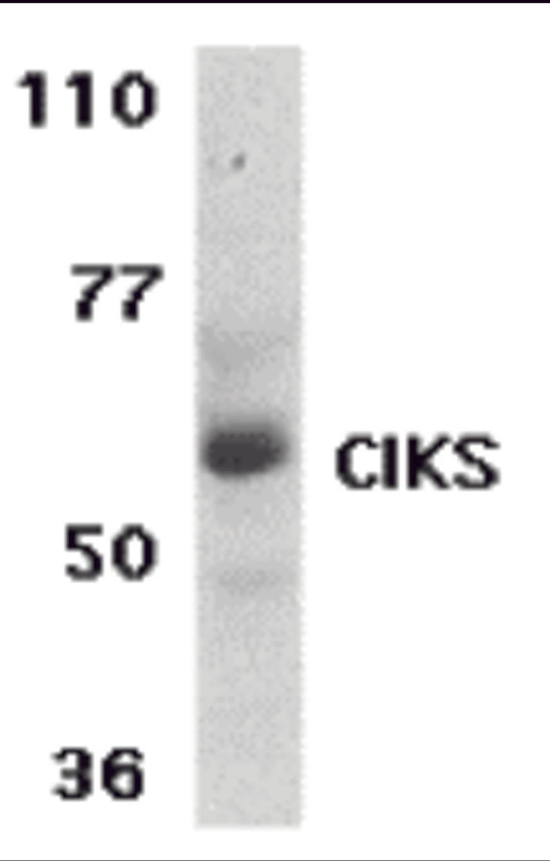 Western blot analysis of CIKS expression in human placenta tissue lysate with CIKS antibody at 1 μg /ml.