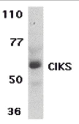 Western blot analysis of CIKS expression in human placenta tissue lysate with CIKS antibody at 1 μg /ml.