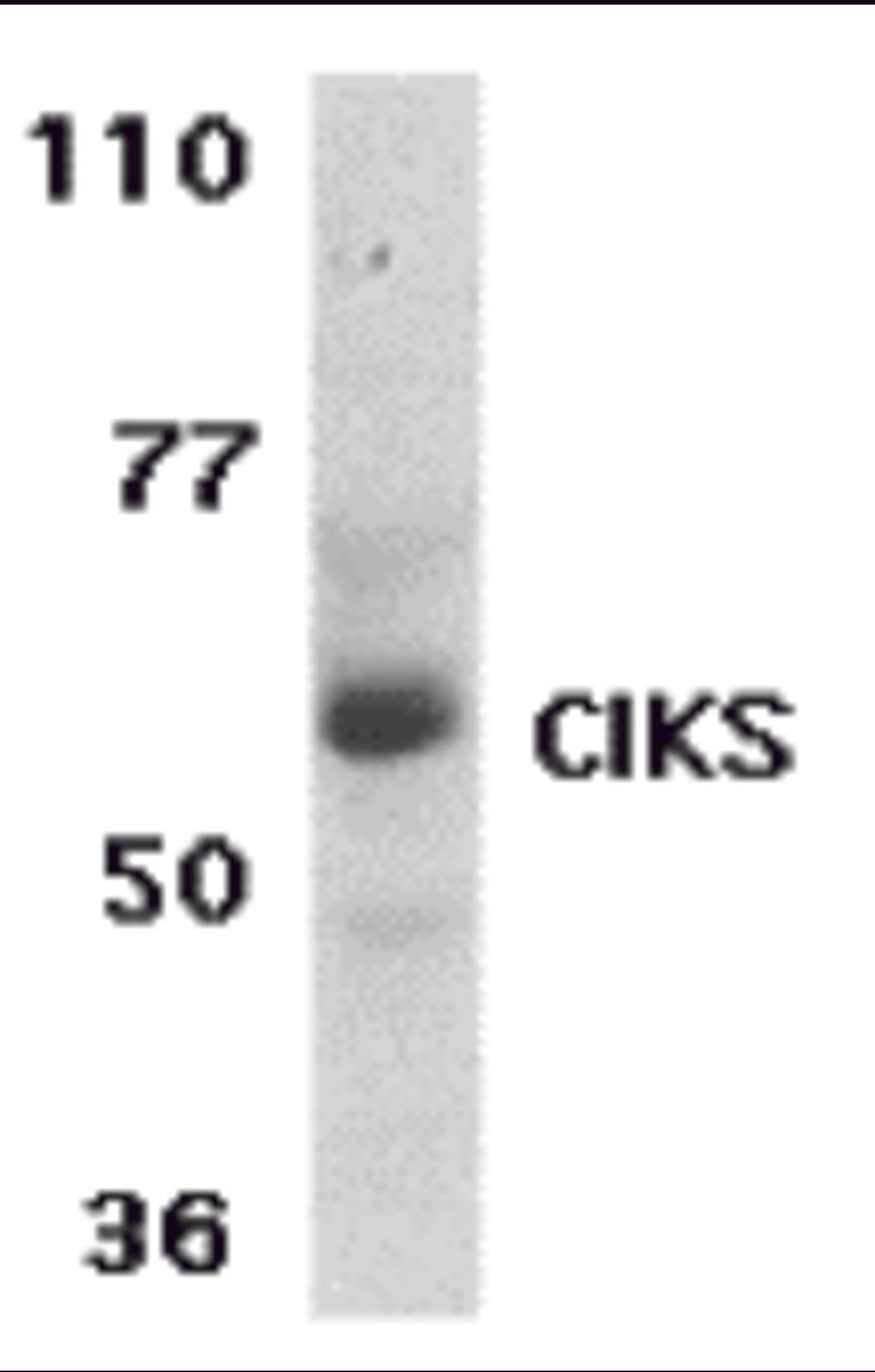 Western blot analysis of CIKS expression in human placenta tissue lysate with CIKS antibody at 1 μg /ml.