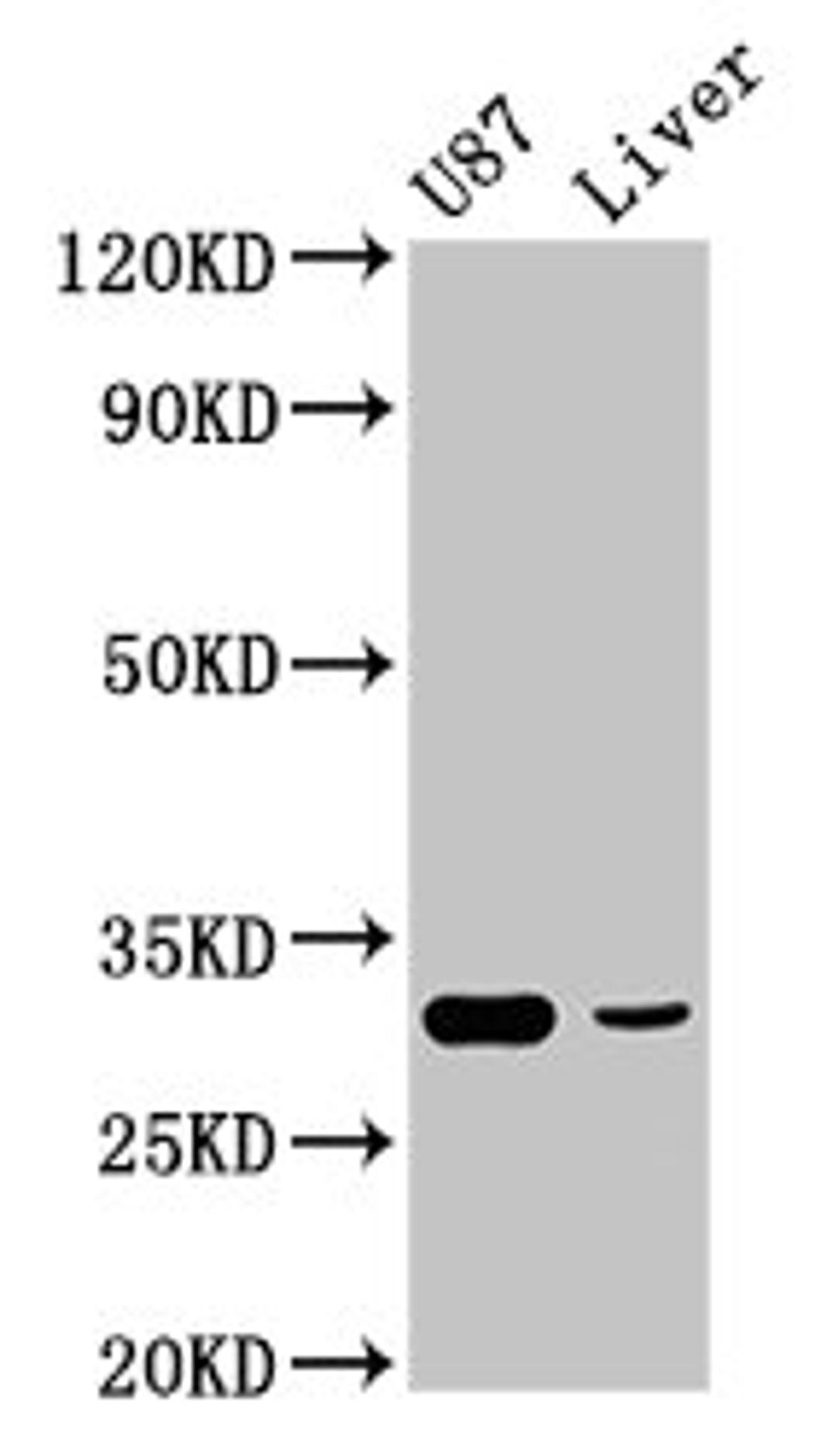 Western Blot. Positive WB detected in: U87 whole cell lysate, Rat liver tissue. All lanes: ITM2B antibody at 4.9µg/ml. Secondary. Goat polyclonal to rabbit IgG at 1/50000 dilution. Predicted band size: 54 kDa. Observed band size: 31 kDa