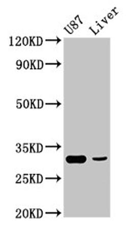 Western Blot. Positive WB detected in: U87 whole cell lysate, Rat liver tissue. All lanes: ITM2B antibody at 4.9µg/ml. Secondary. Goat polyclonal to rabbit IgG at 1/50000 dilution. Predicted band size: 54 kDa. Observed band size: 31 kDa
