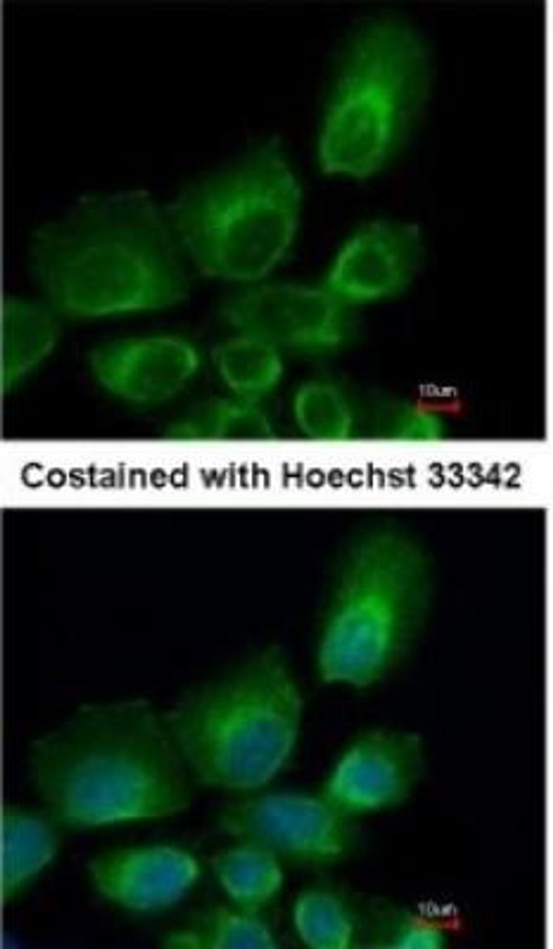 Immunocytochemistry/Immunofluorescence: HR6B/UBE2B Antibody [NBP1-31293] - Paraformaldehyde-fixed A431, using antibody at 1:500 dilution.