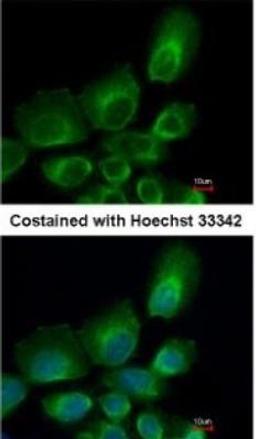 Immunocytochemistry/Immunofluorescence: HR6B/UBE2B Antibody [NBP1-31293] - Paraformaldehyde-fixed A431, using antibody at 1:500 dilution.