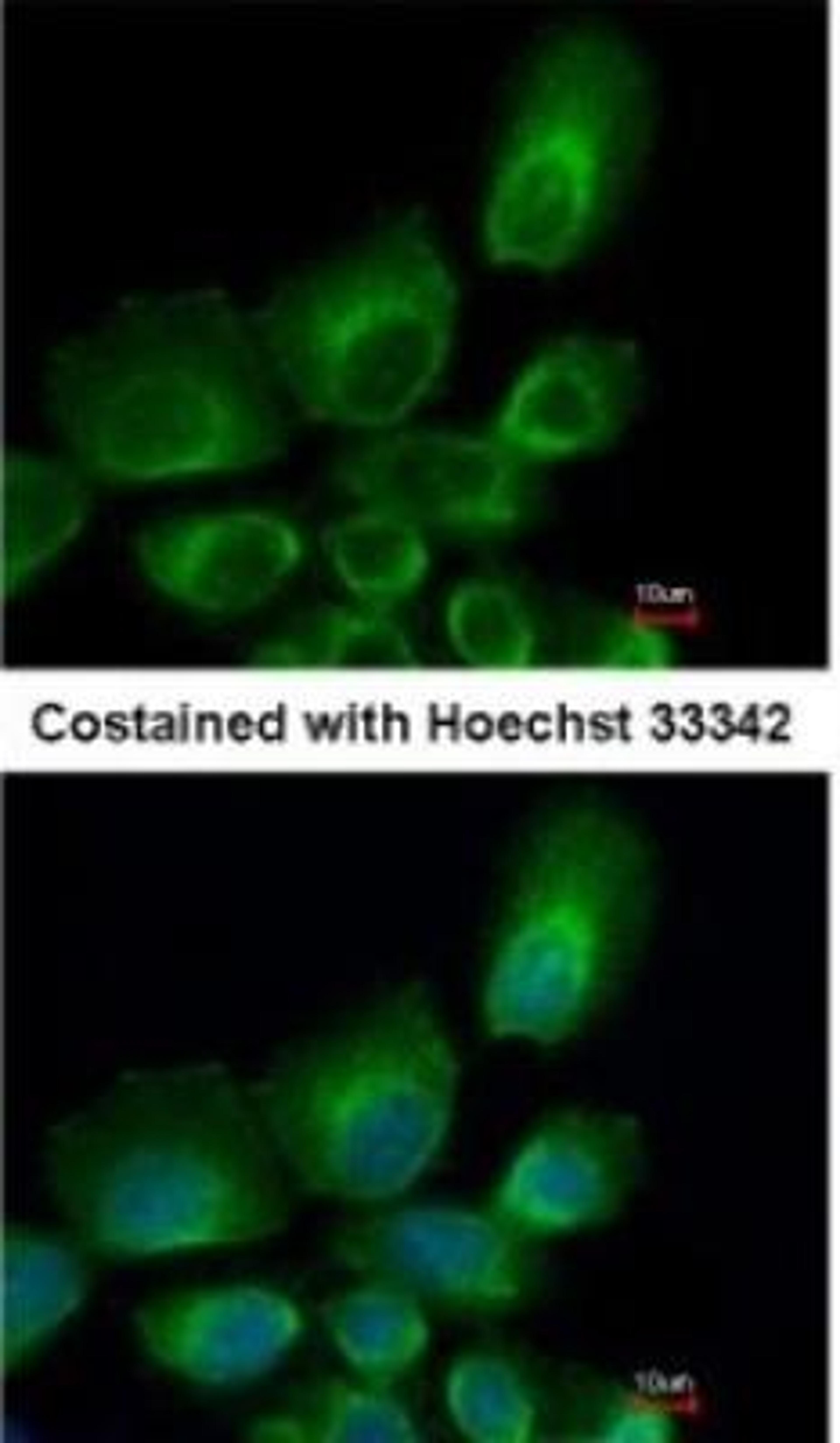 Immunocytochemistry/Immunofluorescence: HR6B/UBE2B Antibody [NBP1-31293] - Paraformaldehyde-fixed A431, using antibody at 1:500 dilution.