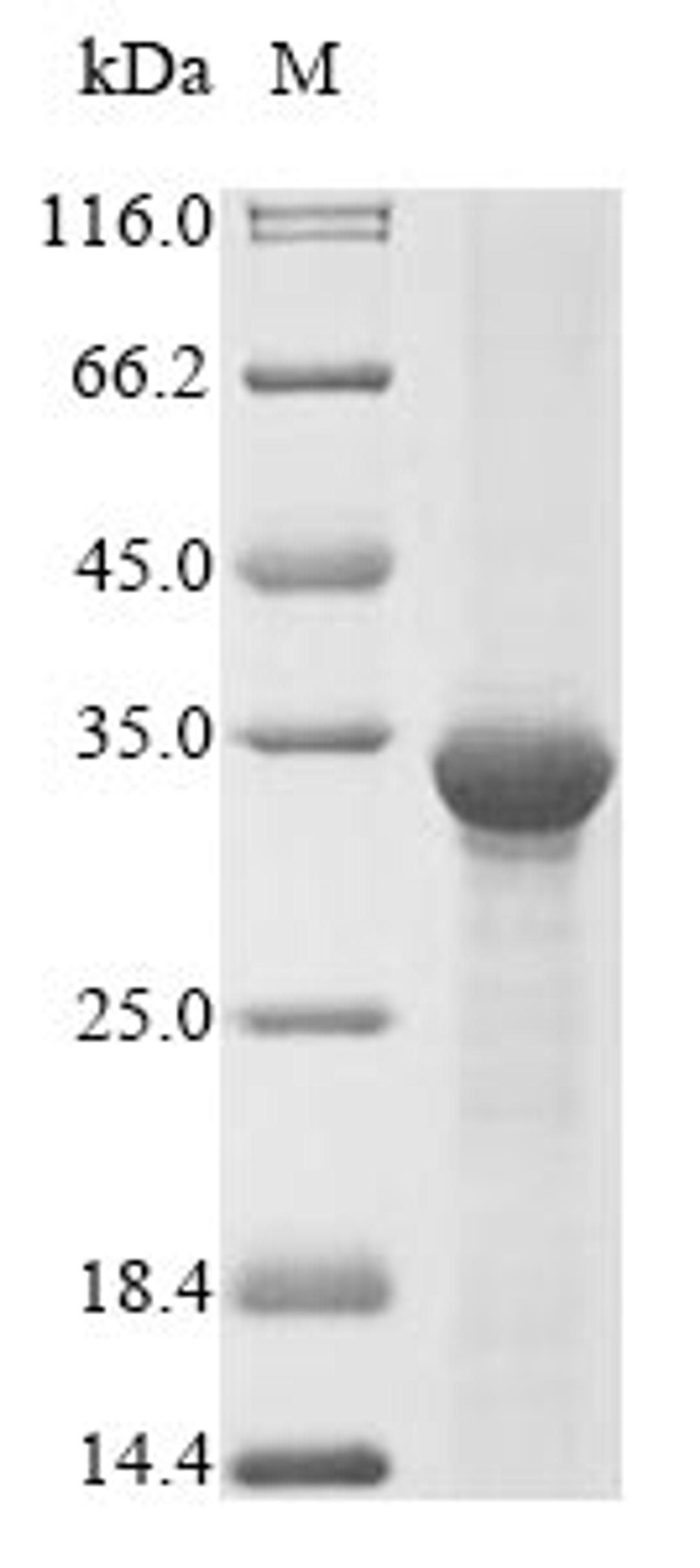 (Tris-Glycine gel) Discontinuous SDS-PAGE (reduced) with 5% enrichment gel and 15% separation gel.