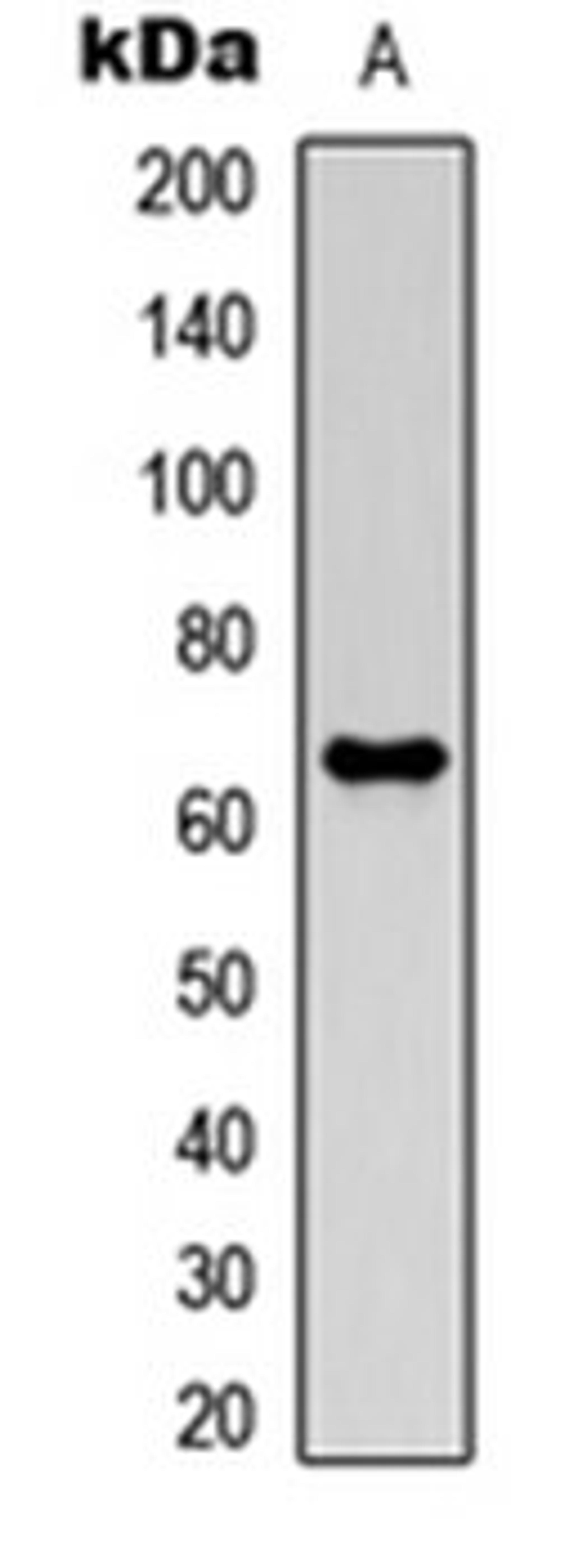 Western blot analysis of HEK293T (Lane 1) whole cell lysates using MMP21 antibody