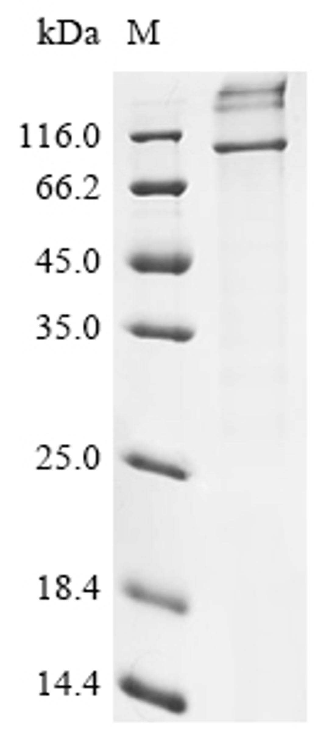 (Tris-Glycine gel) Discontinuous SDS-PAGE (reduced) with 5% enrichment gel and 15% separation gel.