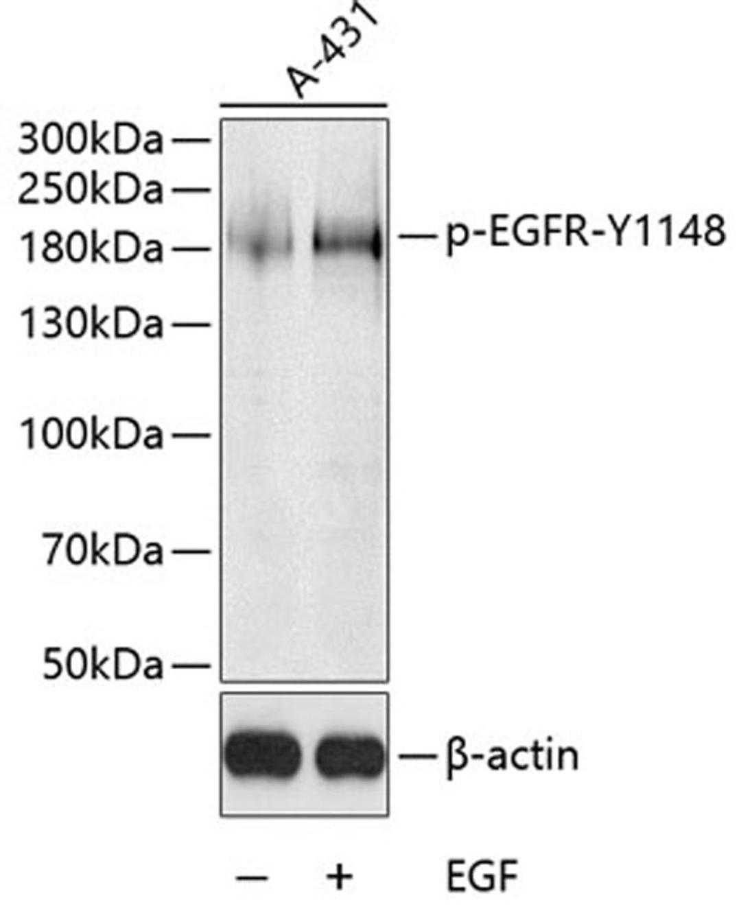 Western blot - Phospho-EGFR-Y1148 antibody (AP0028)