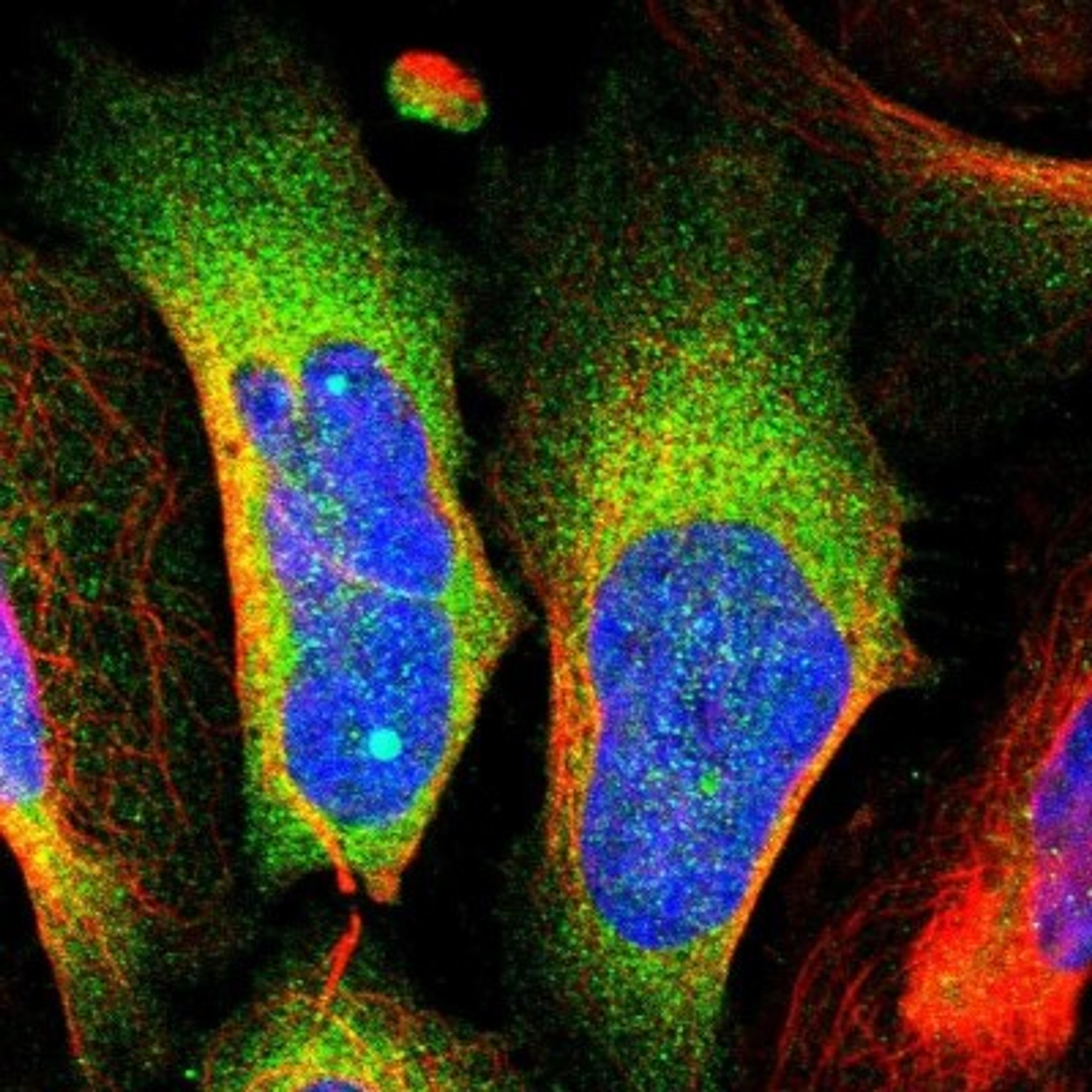 Immunocytochemistry/Immunofluorescence: GALT Antibody [NBP1-86133] - Immunofluorescent staining of human cell line U-2 OS shows positivity in cytoplasm.