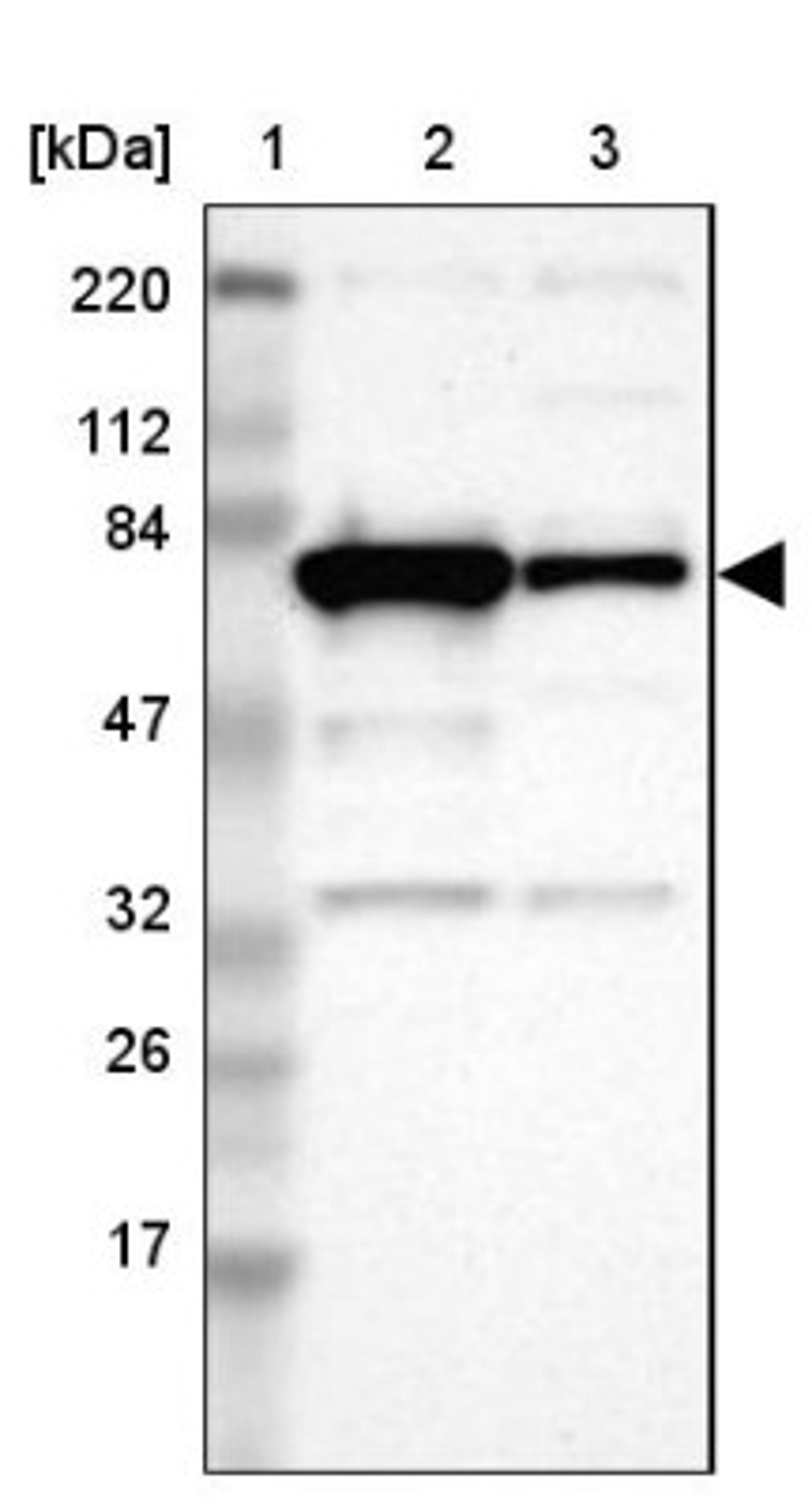 Western Blot: Optineurin Antibody [NBP1-84682] - Lane 1: Marker [kDa] 220, 112, 84, 47, 32, 26, 17<br/>Lane 2: Human cell line RT-4<br/>Lane 3: Human cell line U-251MG sp