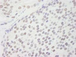 Detection of human CPSF160 by immunohistochemistry.