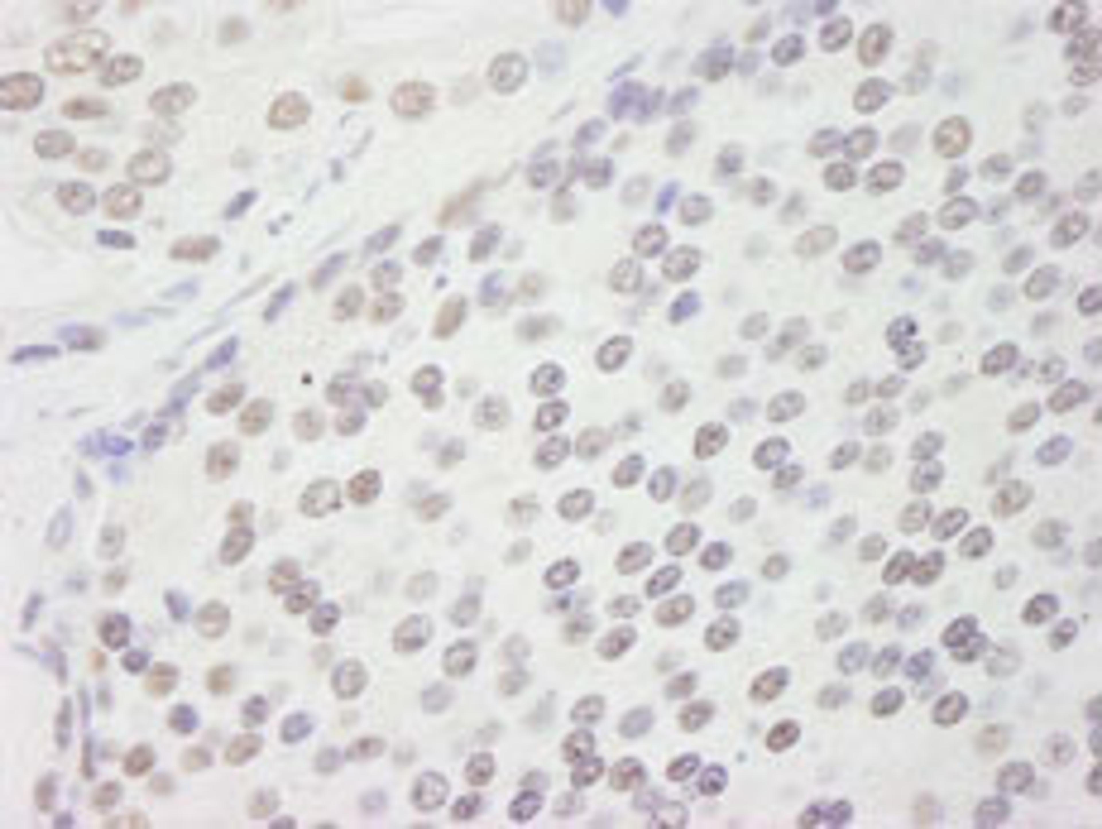 Detection of human CPSF160 by immunohistochemistry.