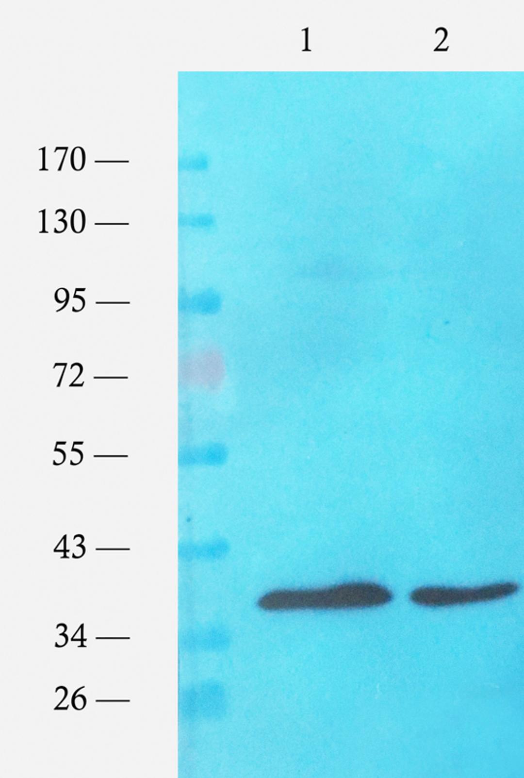 Western blot analysis of E. coli strains (lane 1), E. coli strains (lane 2) using ompC antibody (1 ug/ml)