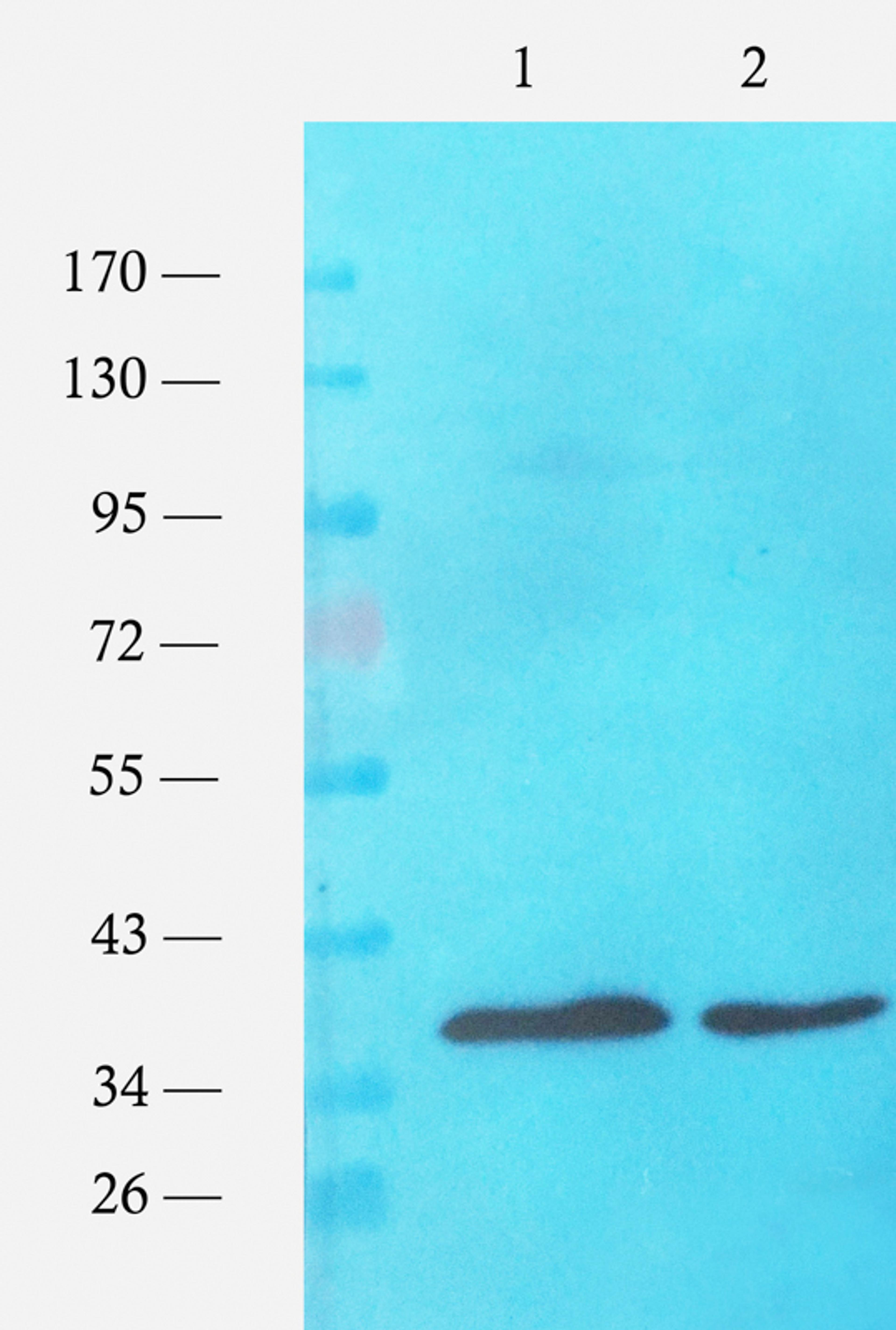 Western blot analysis of E. coli strains (lane 1), E. coli strains (lane 2) using ompC antibody (1 ug/ml)