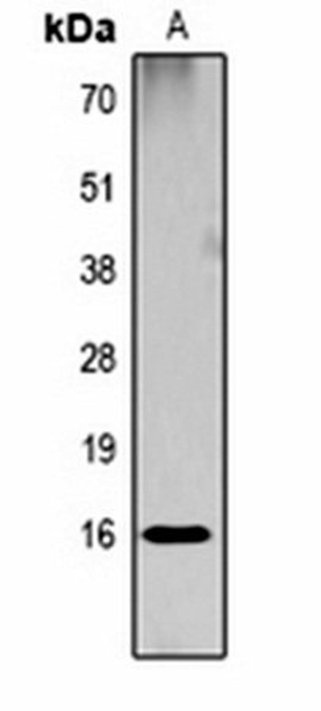 Western blot analysis of  Hela (Lane1) whole cell lysates using Histone H3 (DiMethyl K18) antibody