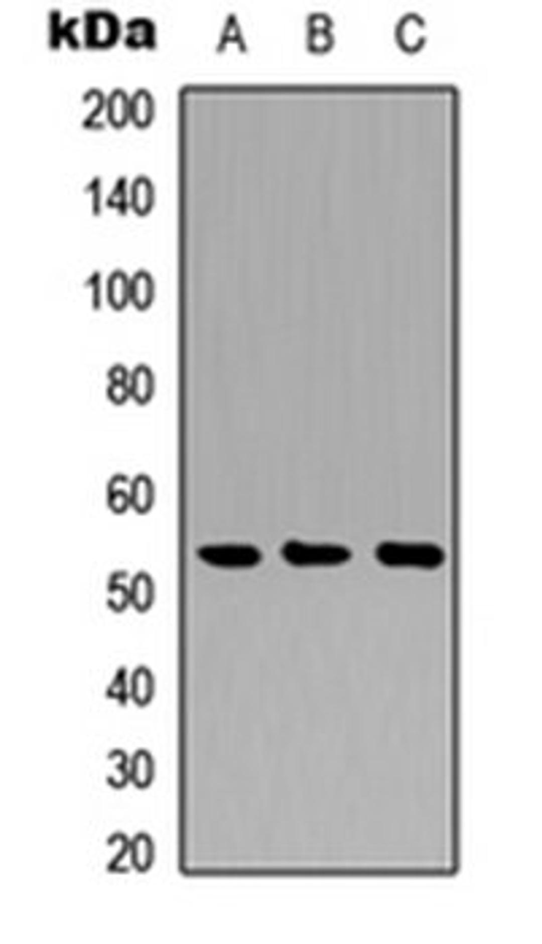 Western blot analysis of A549 (Lane 1), NS-1 (Lane 2), PC12 (Lane 3) whole cell lysates using Cathepsin A 20k antibody