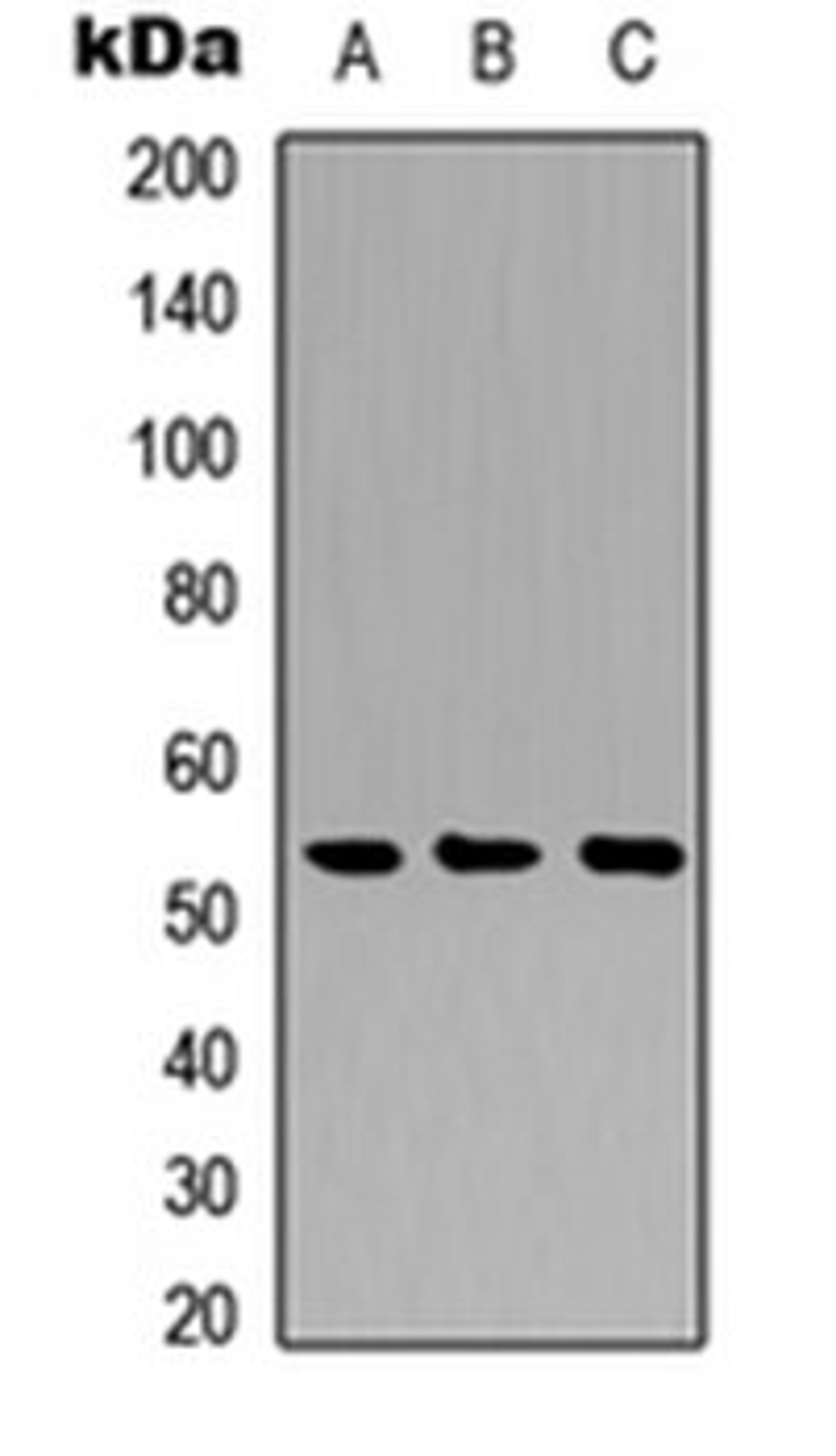 Western blot analysis of A549 (Lane 1), NS-1 (Lane 2), PC12 (Lane 3) whole cell lysates using Cathepsin A 20k antibody