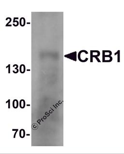 Western blot analysis of CRB1 in human small intestine Tissue lysate with CRB1 antibody at 1 μg/mL.