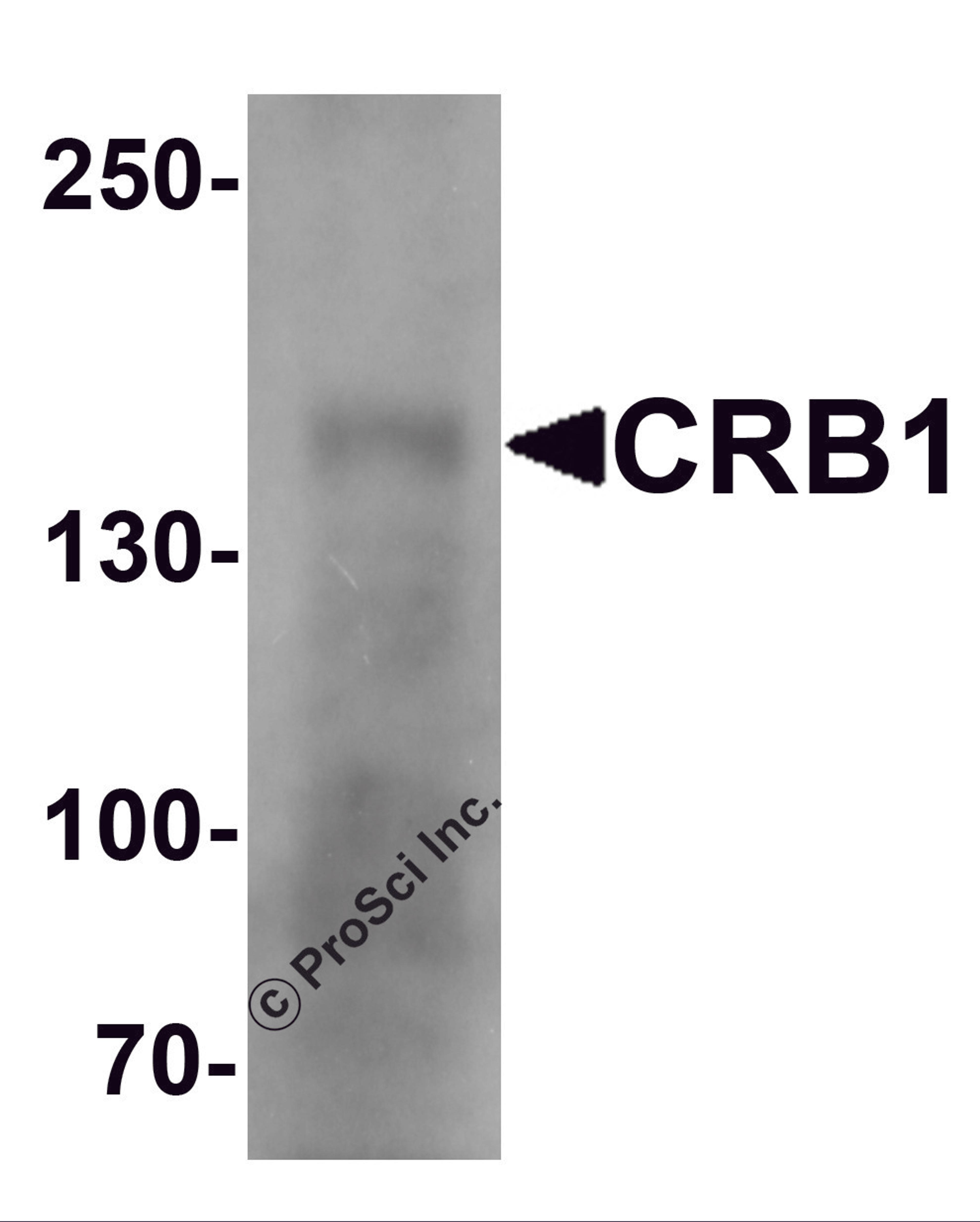 Western blot analysis of CRB1 in human small intestine Tissue lysate with CRB1 antibody at 1 μg/mL.