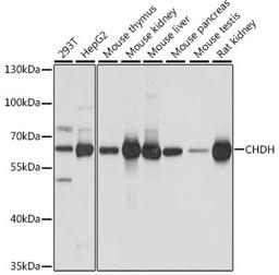 Western blot - CHDH antibody (A16545)