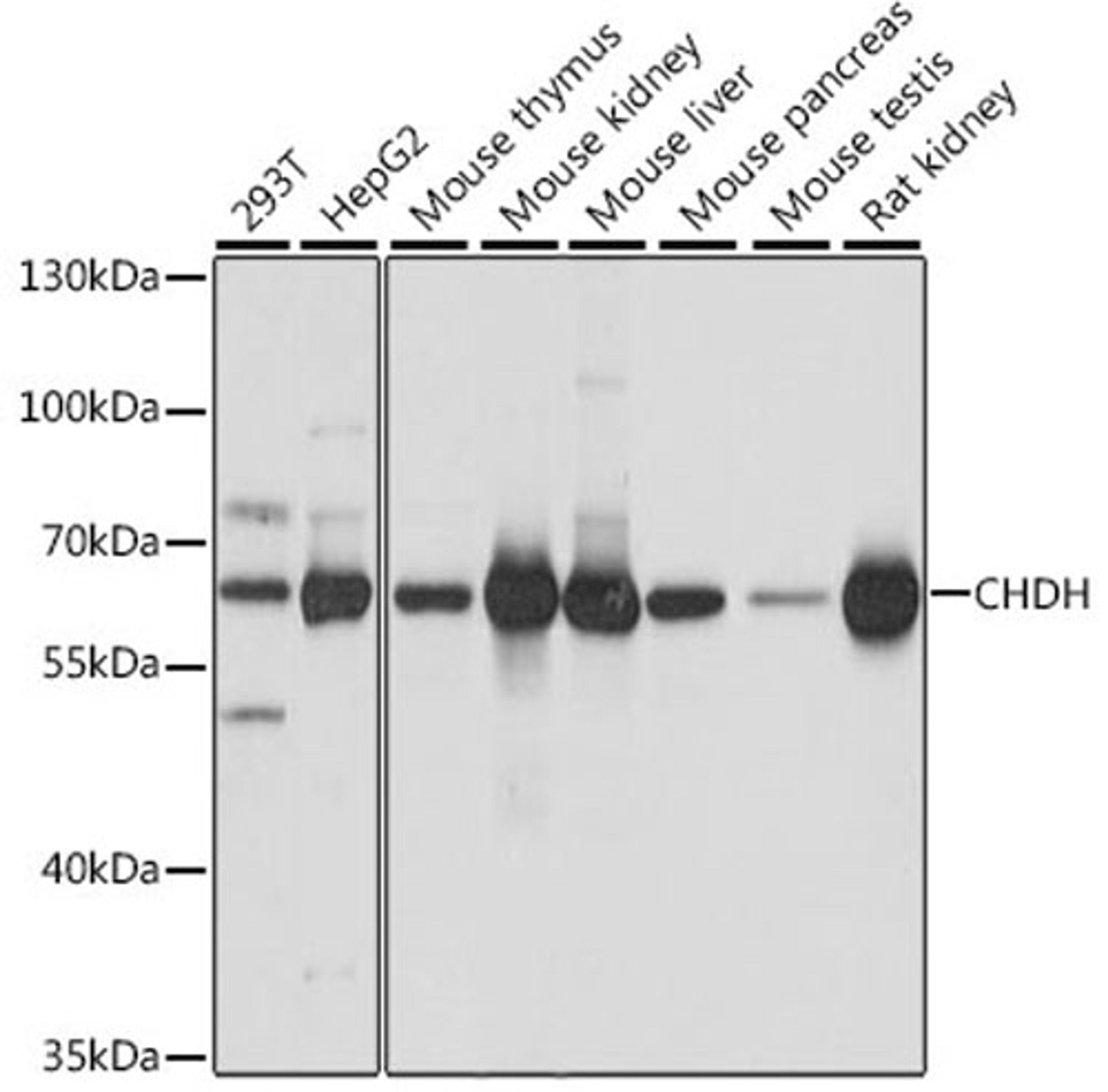 Western blot - CHDH antibody (A16545)