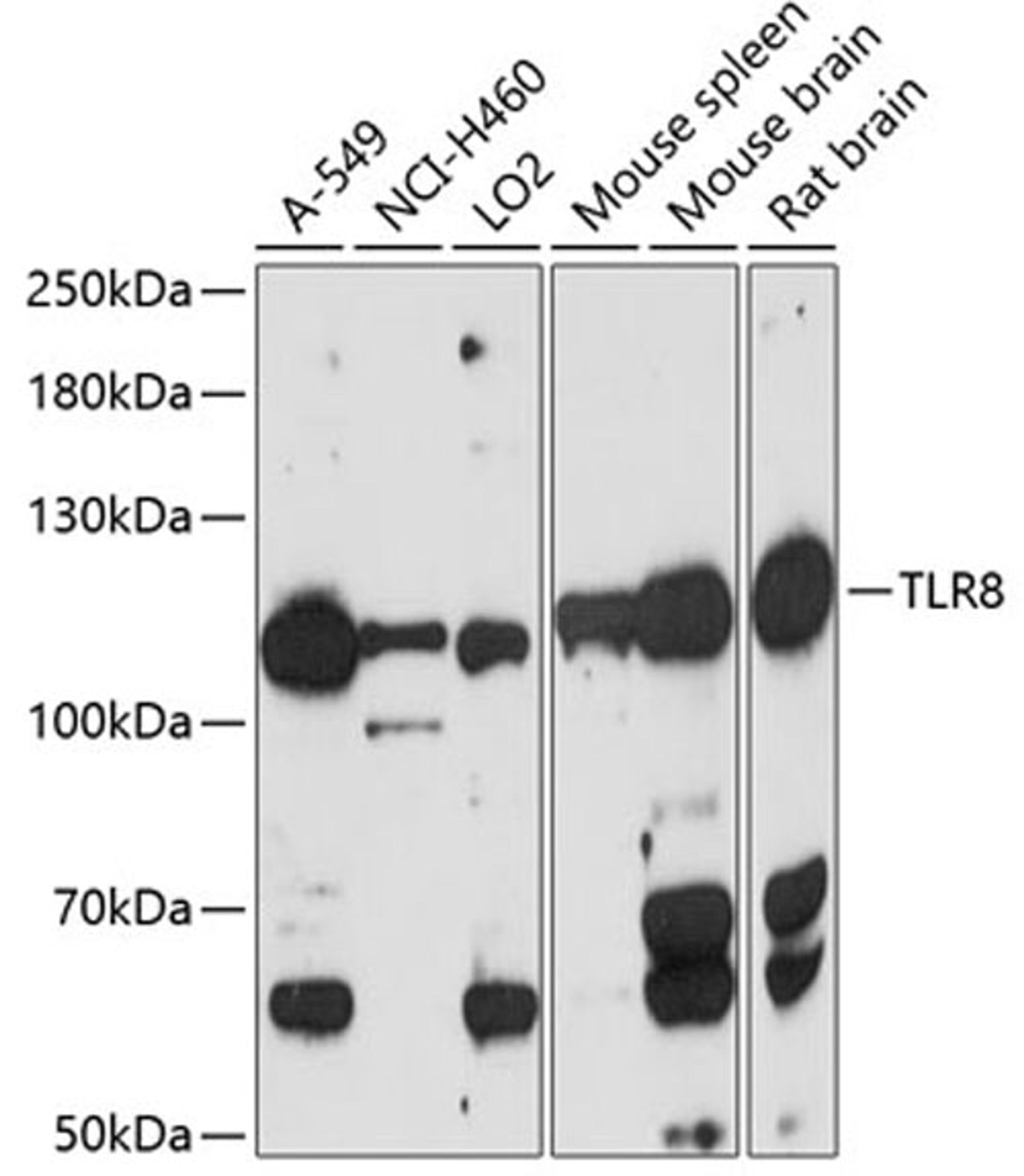 Western blot - TLR8 antibody (A12906)