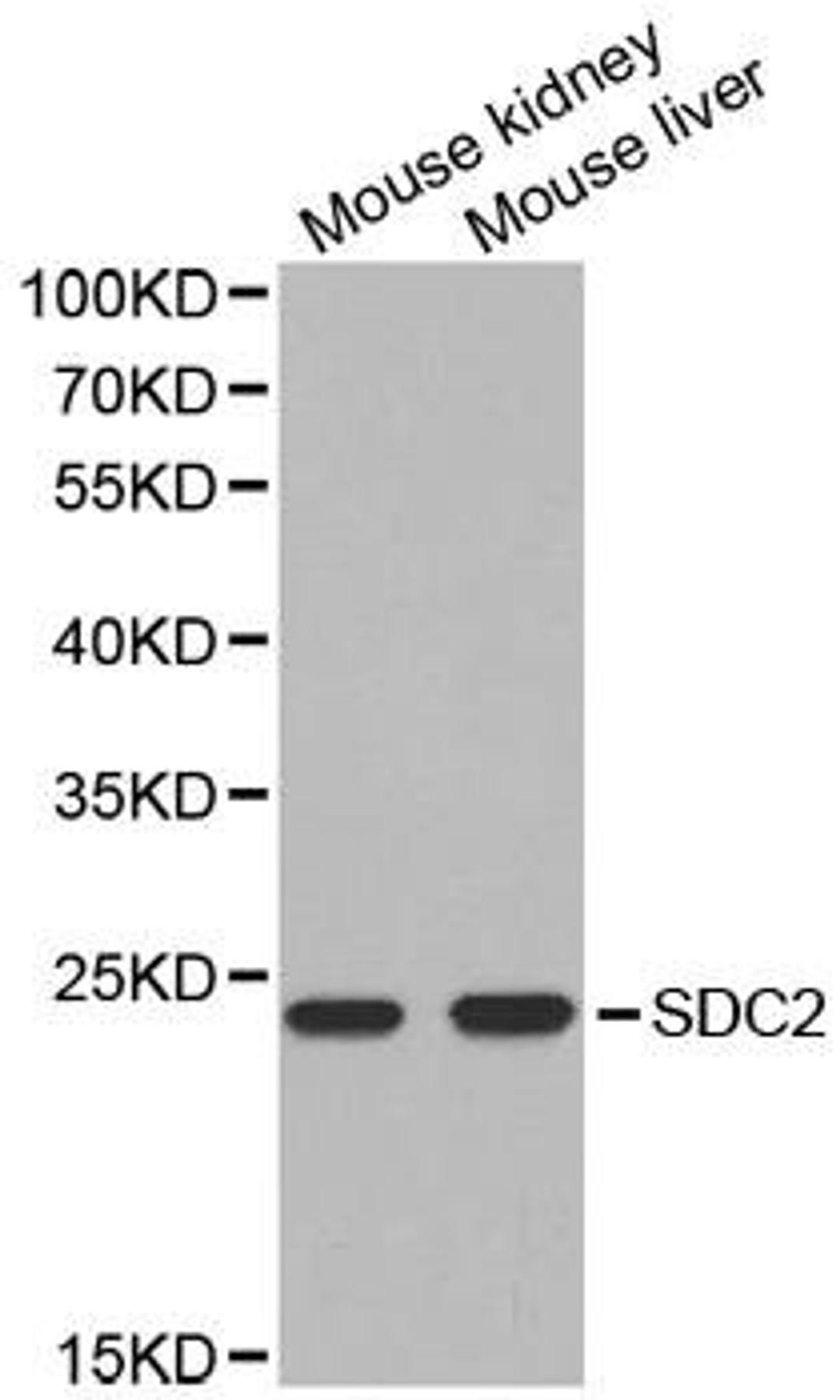 Western blot analysis of extracts of various cell lines using SDC2 antibody