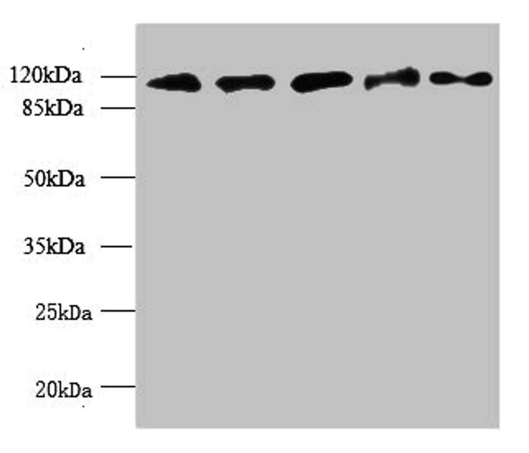 Western blot. All lanes: MORC2 antibody at 6ug/ml. Lane 1: U87 whole cell lysate. Lane 2: U251 whole cell lysate. Lane 3: Jurkat whole cell lysate. Lane 4: Hela whole cell lysate. Lane 5: MCF-7 whole cell lysate. Secondary. Goat polyclonal to rabbit IgG at 1/10000 dilution. Predicted band size: 118, 111 kDa. Observed band size: 118 kDa.