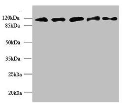 Western blot. All lanes: MORC2 antibody at 6ug/ml. Lane 1: U87 whole cell lysate. Lane 2: U251 whole cell lysate. Lane 3: Jurkat whole cell lysate. Lane 4: Hela whole cell lysate. Lane 5: MCF-7 whole cell lysate. Secondary. Goat polyclonal to rabbit IgG at 1/10000 dilution. Predicted band size: 118, 111 kDa. Observed band size: 118 kDa.