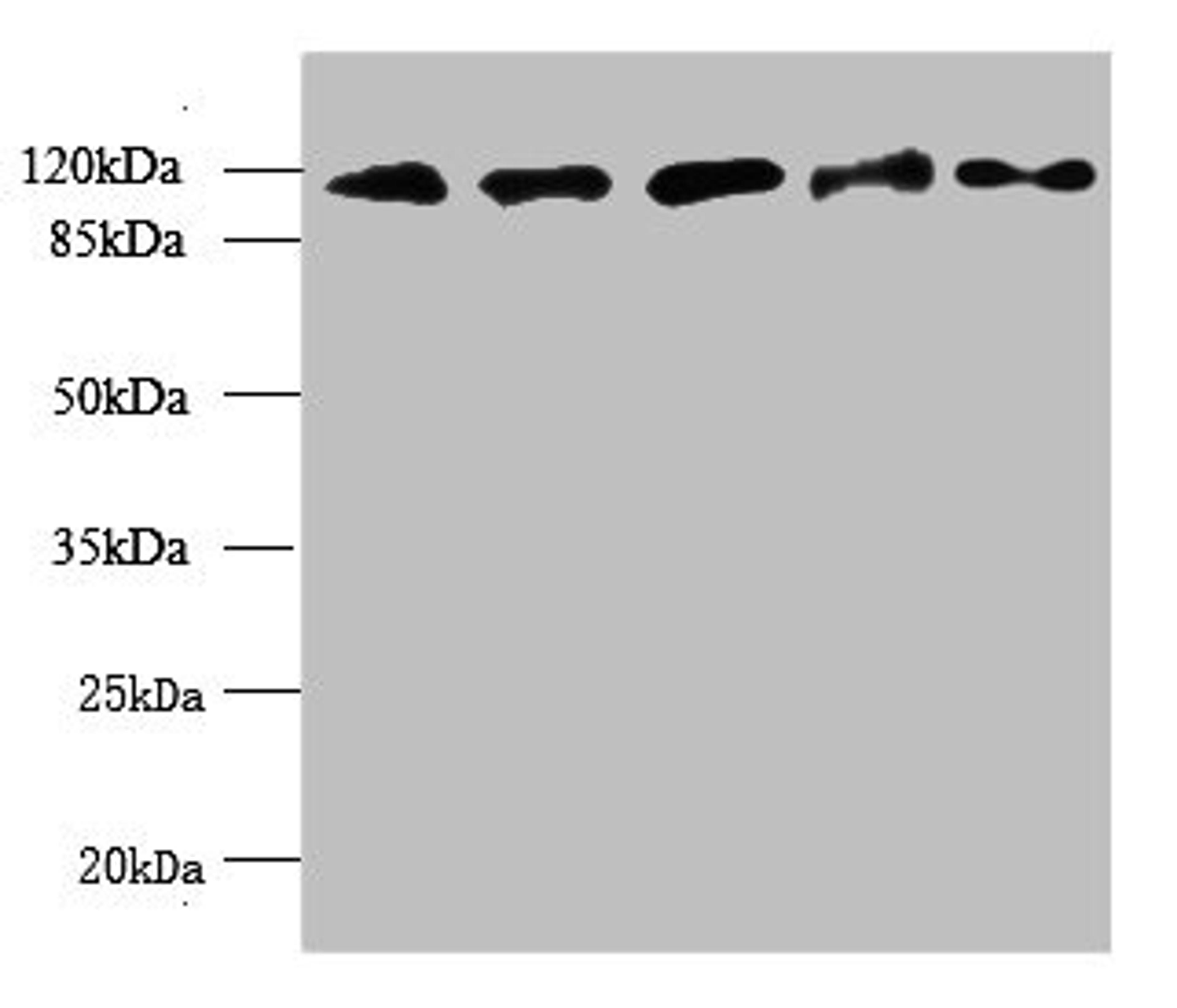 Western blot. All lanes: MORC2 antibody at 6ug/ml. Lane 1: U87 whole cell lysate. Lane 2: U251 whole cell lysate. Lane 3: Jurkat whole cell lysate. Lane 4: Hela whole cell lysate. Lane 5: MCF-7 whole cell lysate. Secondary. Goat polyclonal to rabbit IgG at 1/10000 dilution. Predicted band size: 118, 111 kDa. Observed band size: 118 kDa.