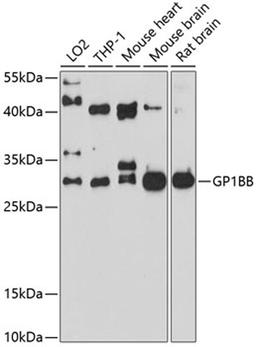 Western blot - GP1BB antibody (A10113)