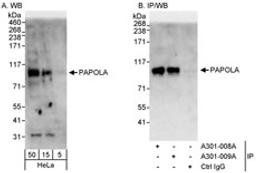 Detection of human PAPOLA by western blot and immunoprecipitation.