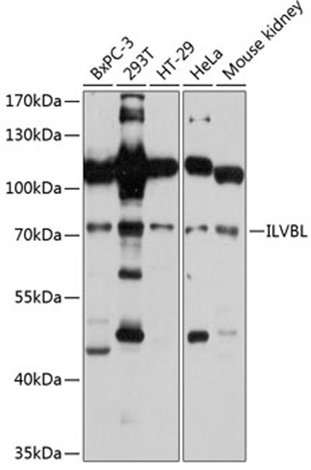 Western blot - ILVBL antibody (A11624)