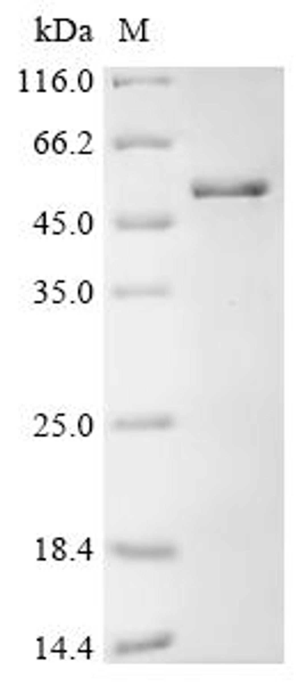 (Tris-Glycine gel) Discontinuous SDS-PAGE (reduced) with 5% enrichment gel and 15% separation gel.