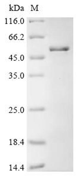 (Tris-Glycine gel) Discontinuous SDS-PAGE (reduced) with 5% enrichment gel and 15% separation gel.