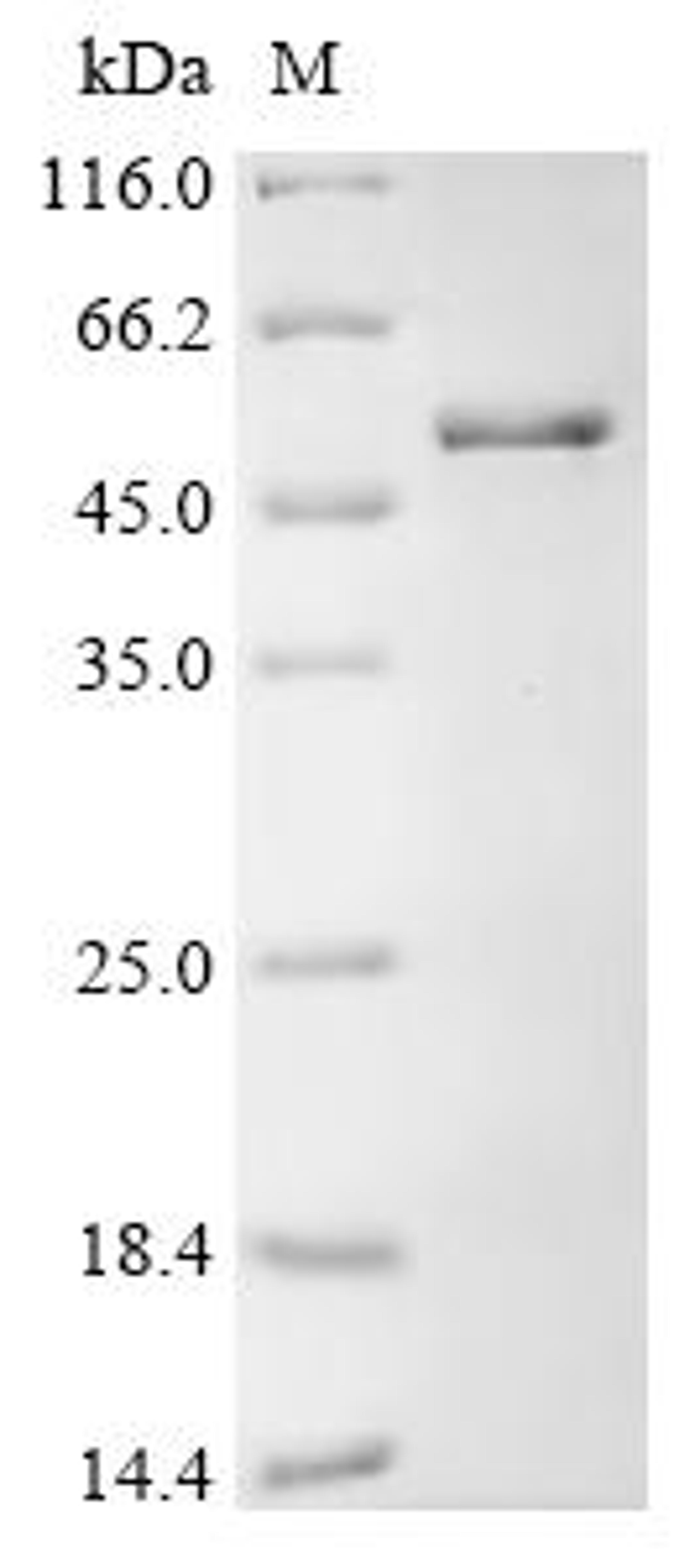(Tris-Glycine gel) Discontinuous SDS-PAGE (reduced) with 5% enrichment gel and 15% separation gel.
