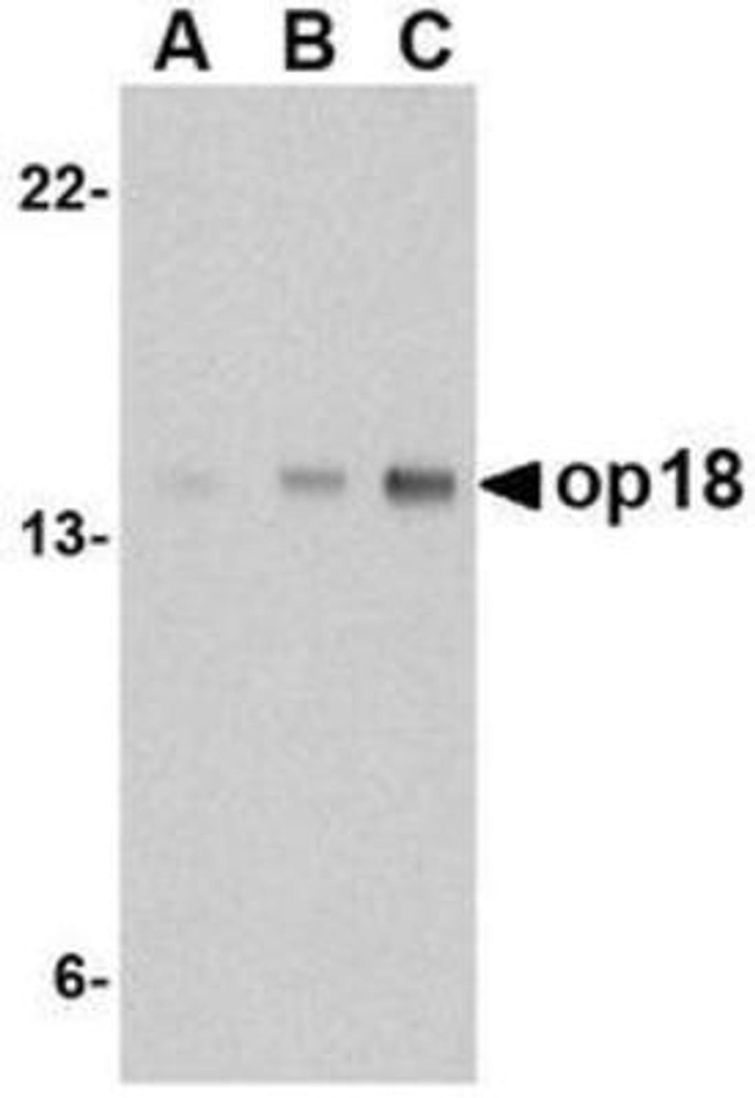 Western Blot: Stathmin 1 Antibody [NBP1-76798] - EL4 cell lysate with op18 antibody at (A) 0.5, (B) 1 and (C) 2 ug/mL.